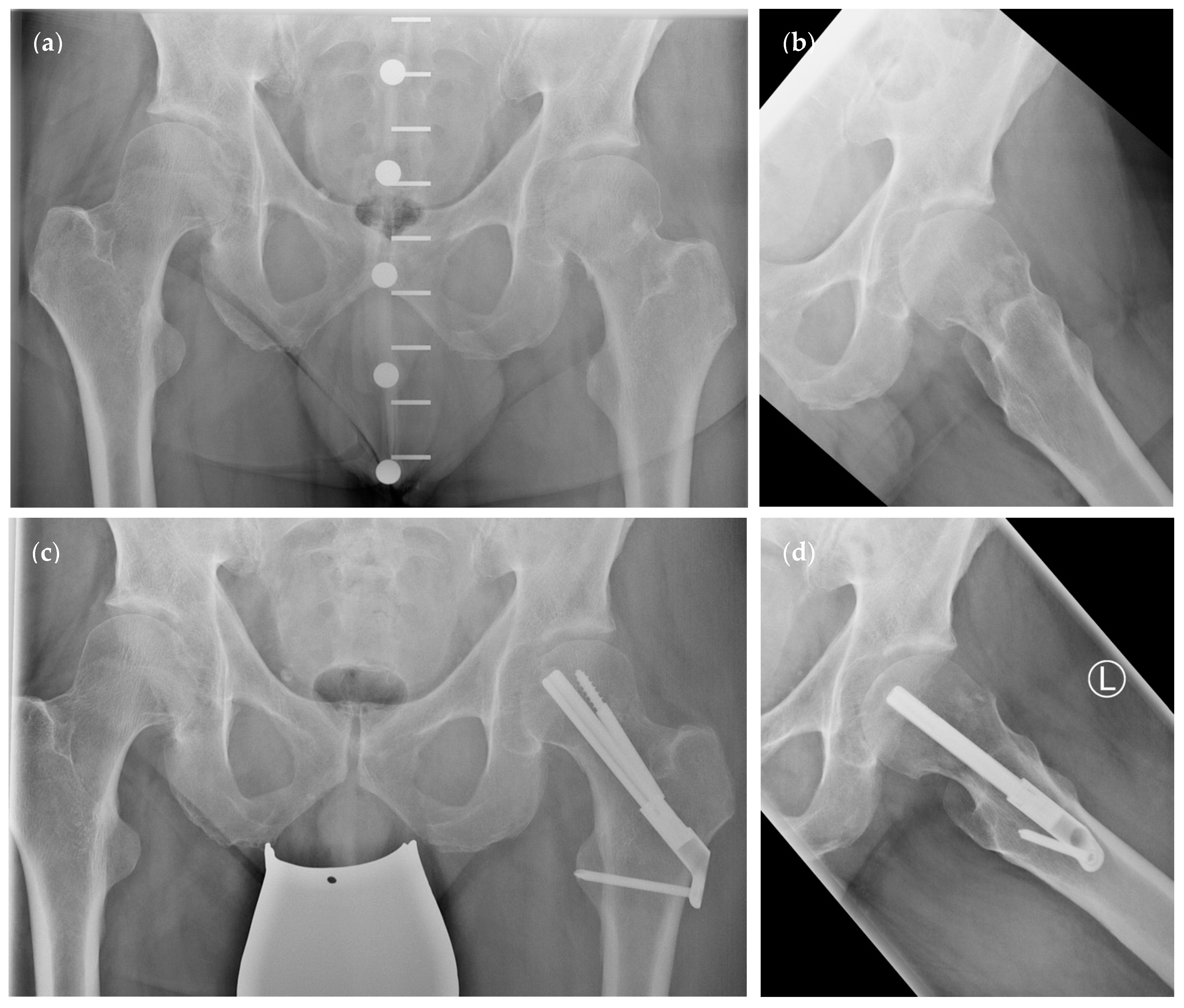 Medicina 58 00352 g002