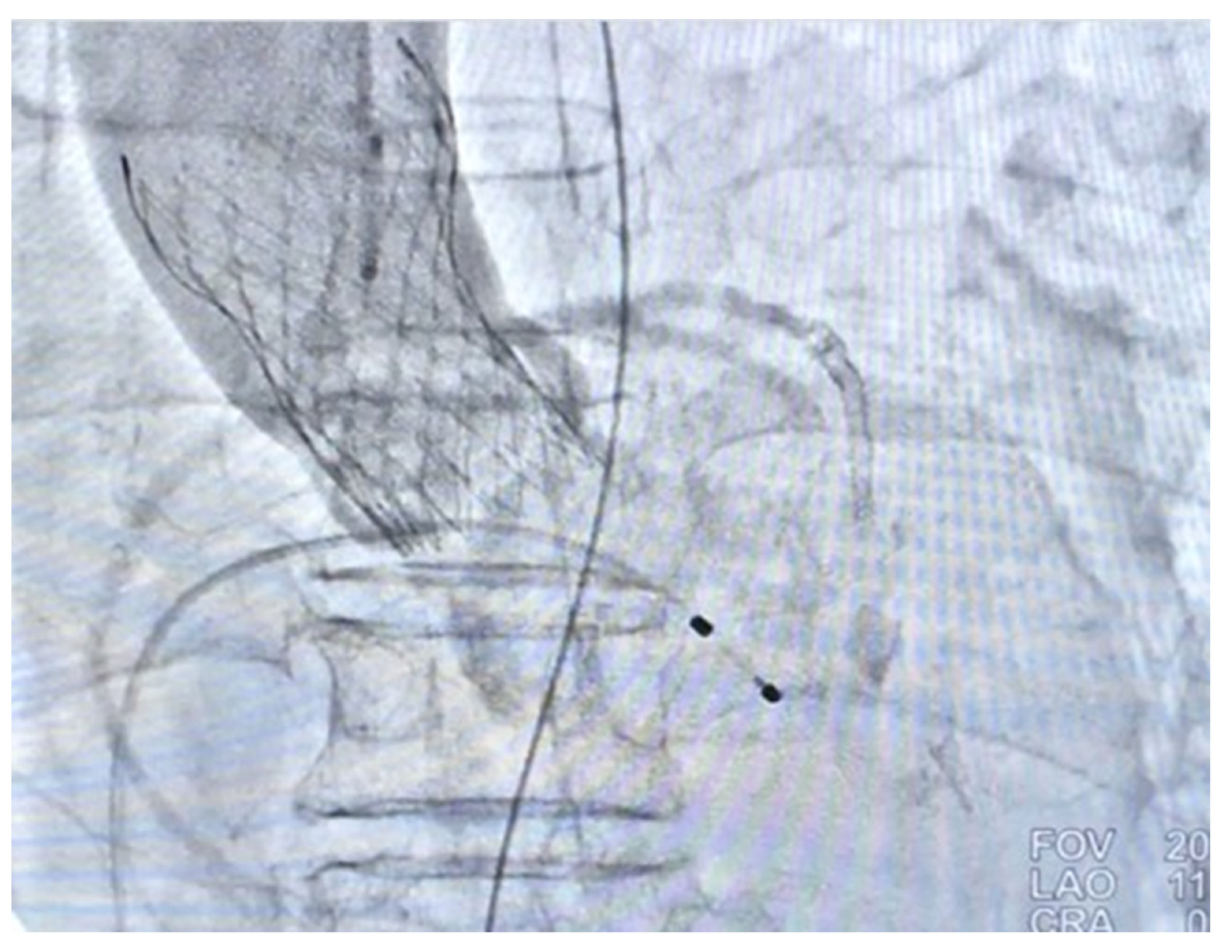 Medicina 58 00356 g003