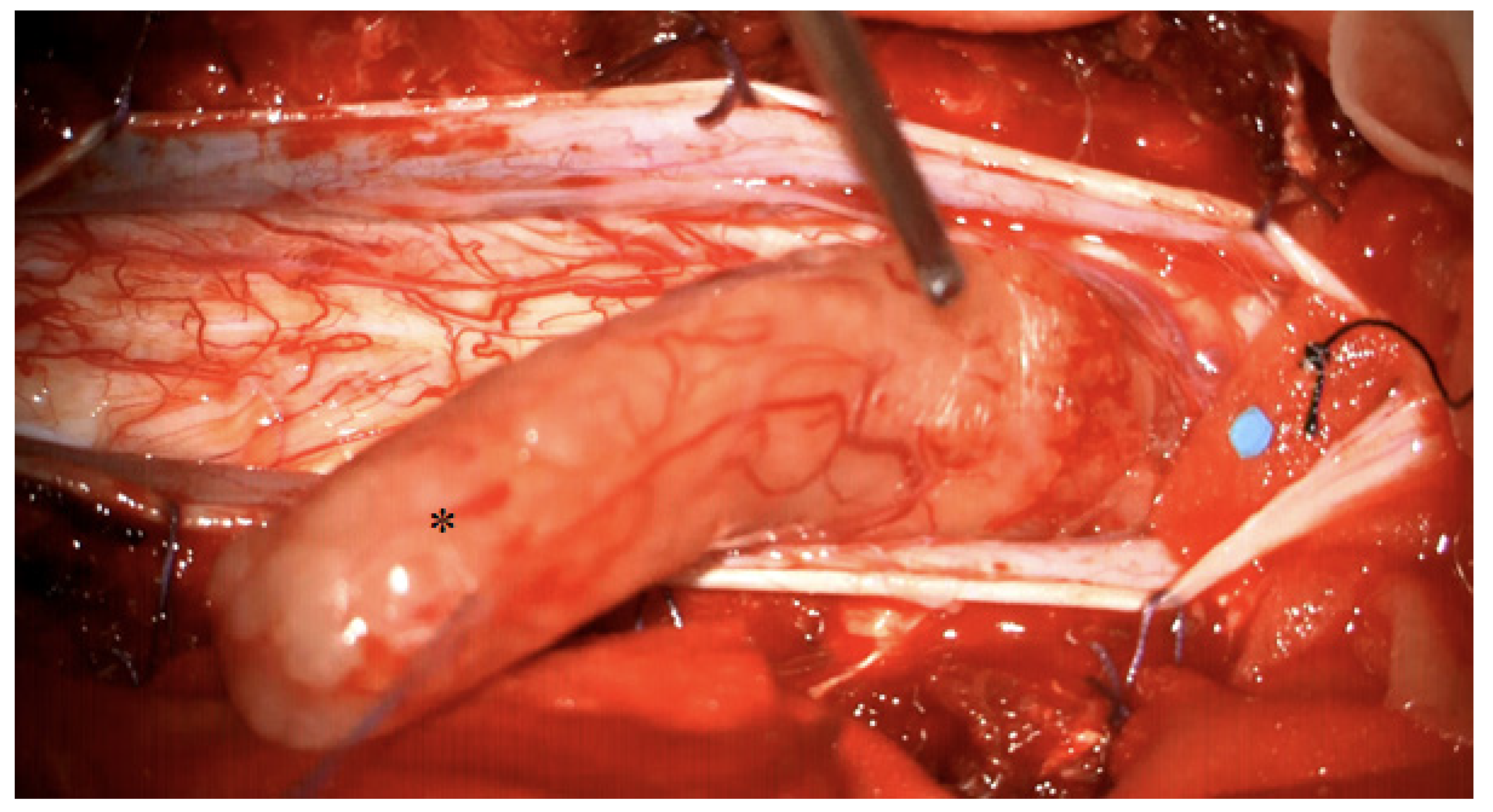 Medicina 58 00357 g003