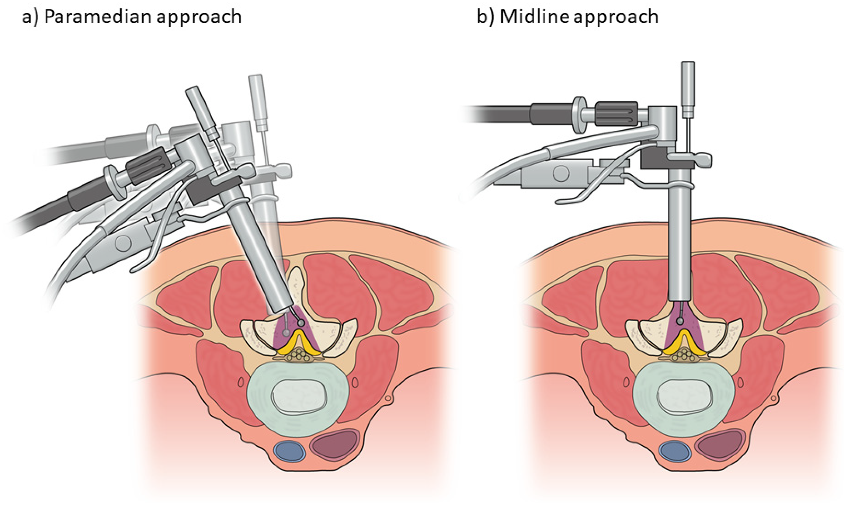 Medicina 58 00384 g003 550