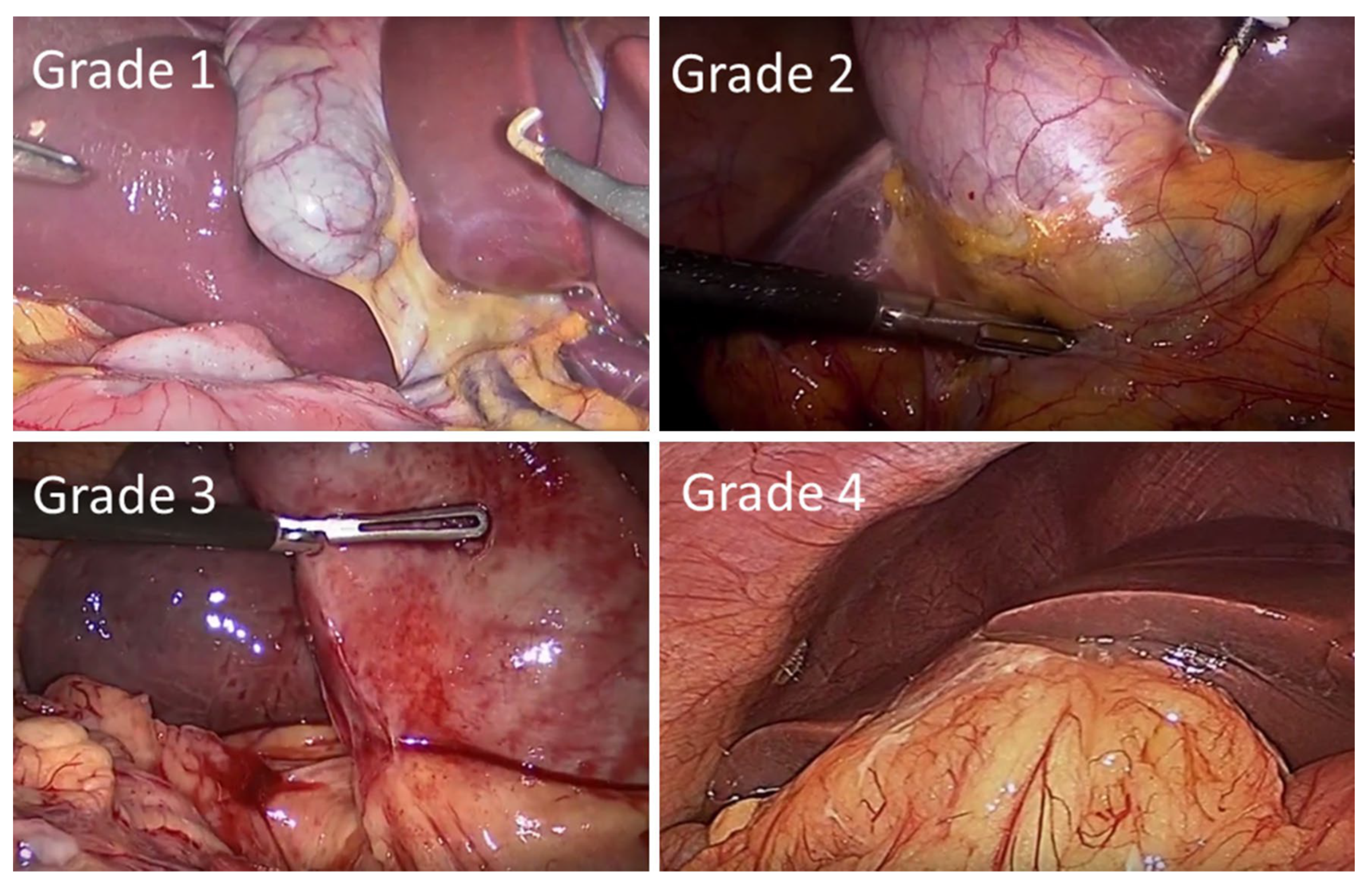 Medicina 58 00388 g002 Medicina 58 00388 g002
