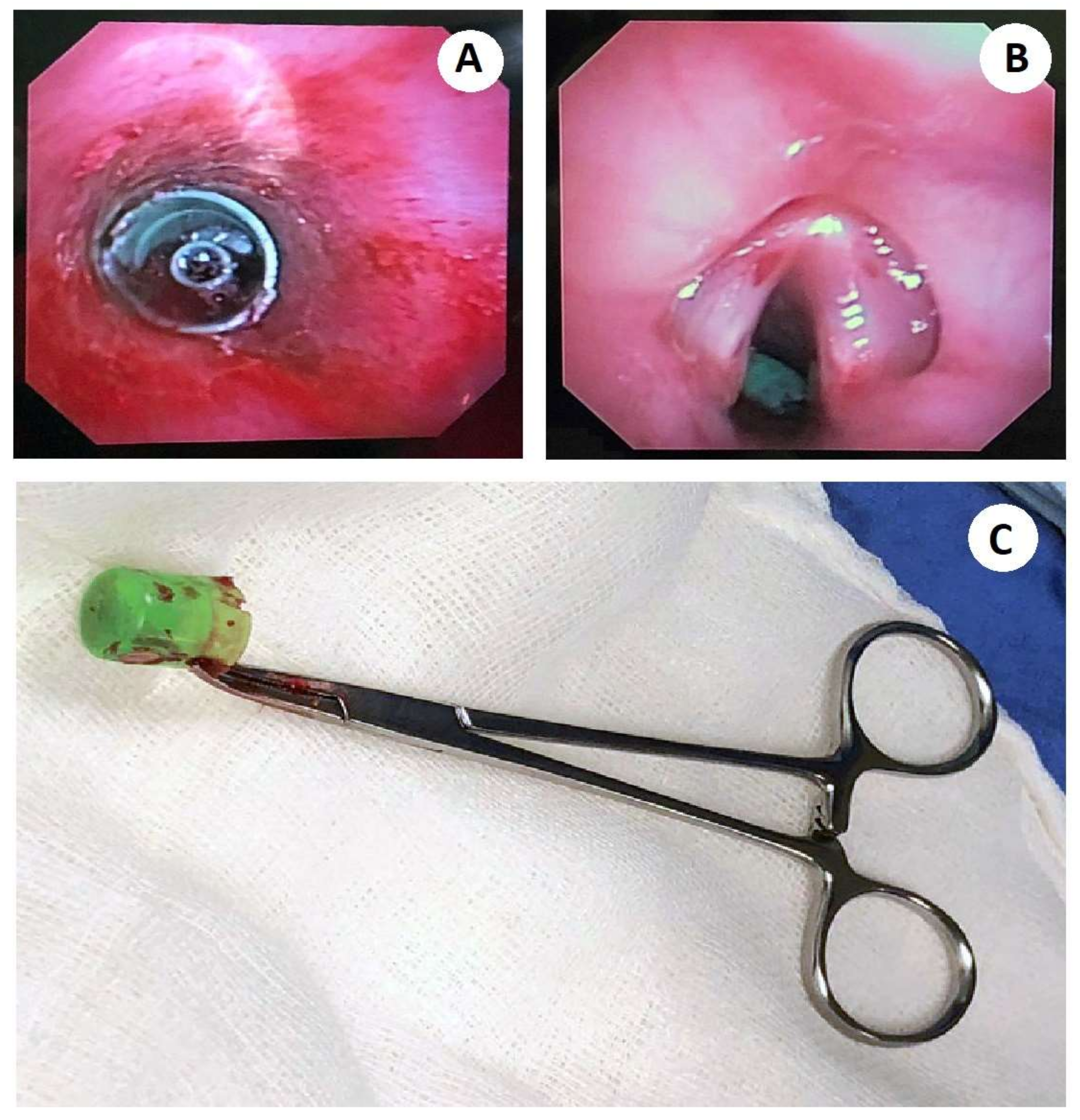 Medicina 58 00396 g002