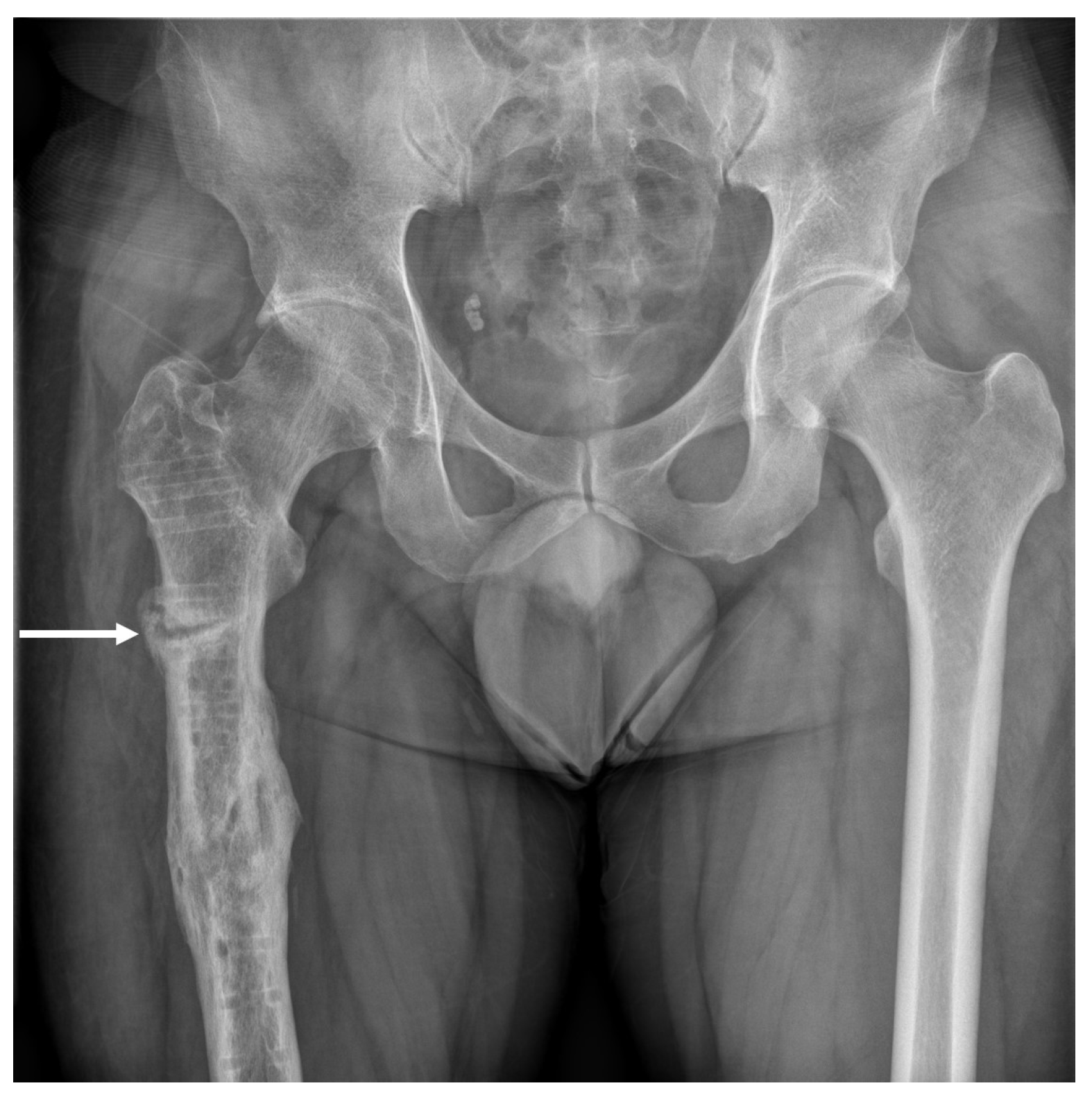 Medicina 58 00404 g002 550