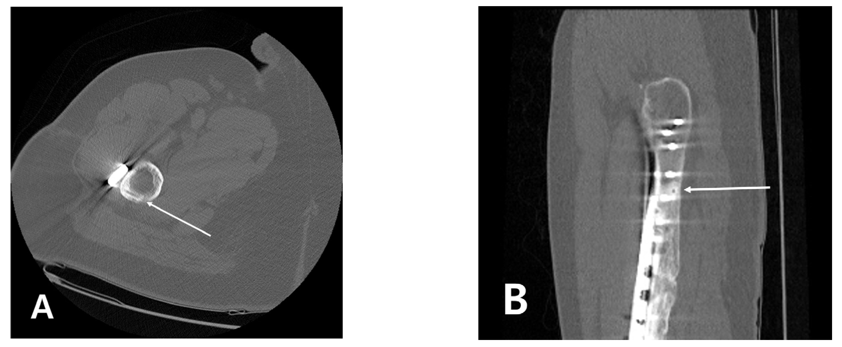 Medicina 58 00404 g005 550