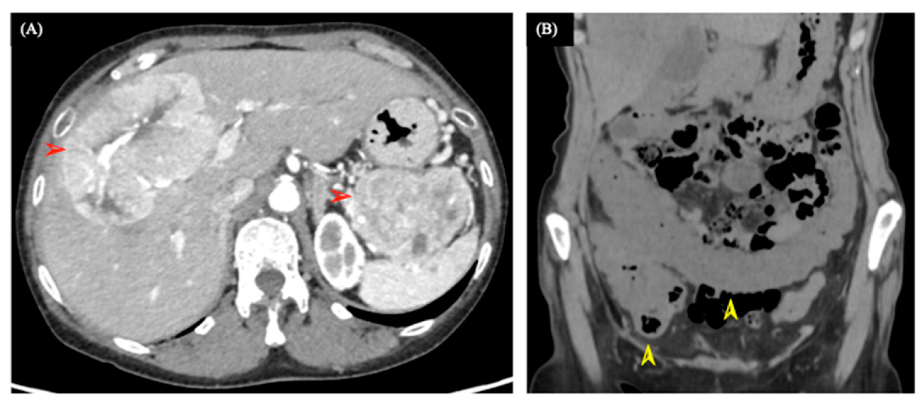 Medicina 58 00410 g001