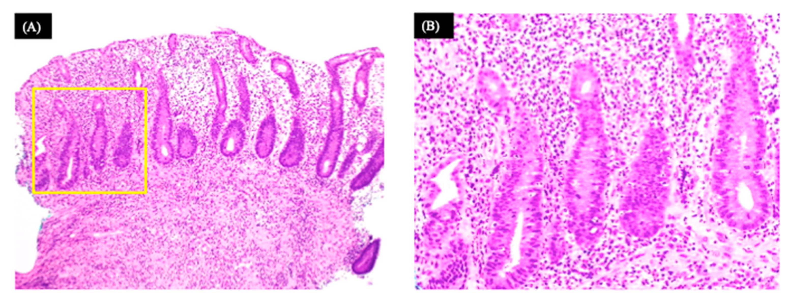 Medicina 58 00410 g003