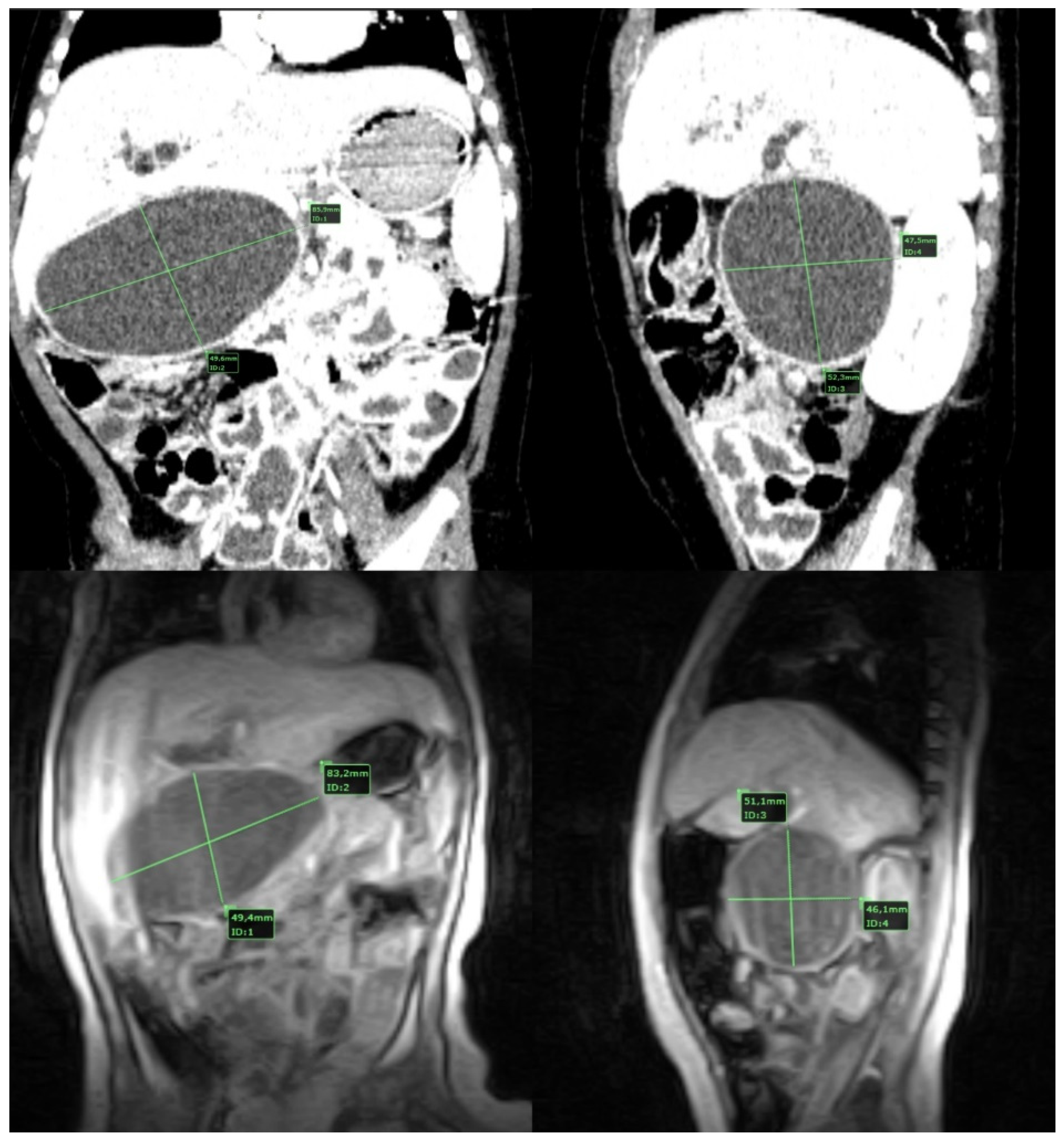Medicina 58 00416 g001