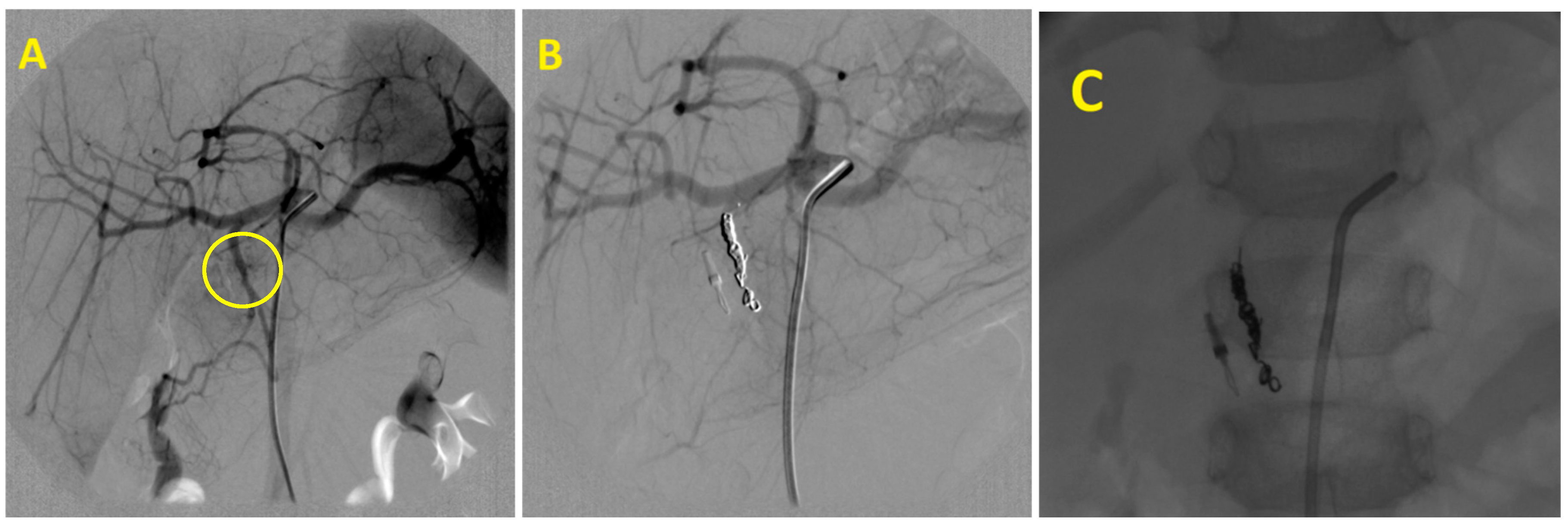 Medicina 58 00424 g002 550