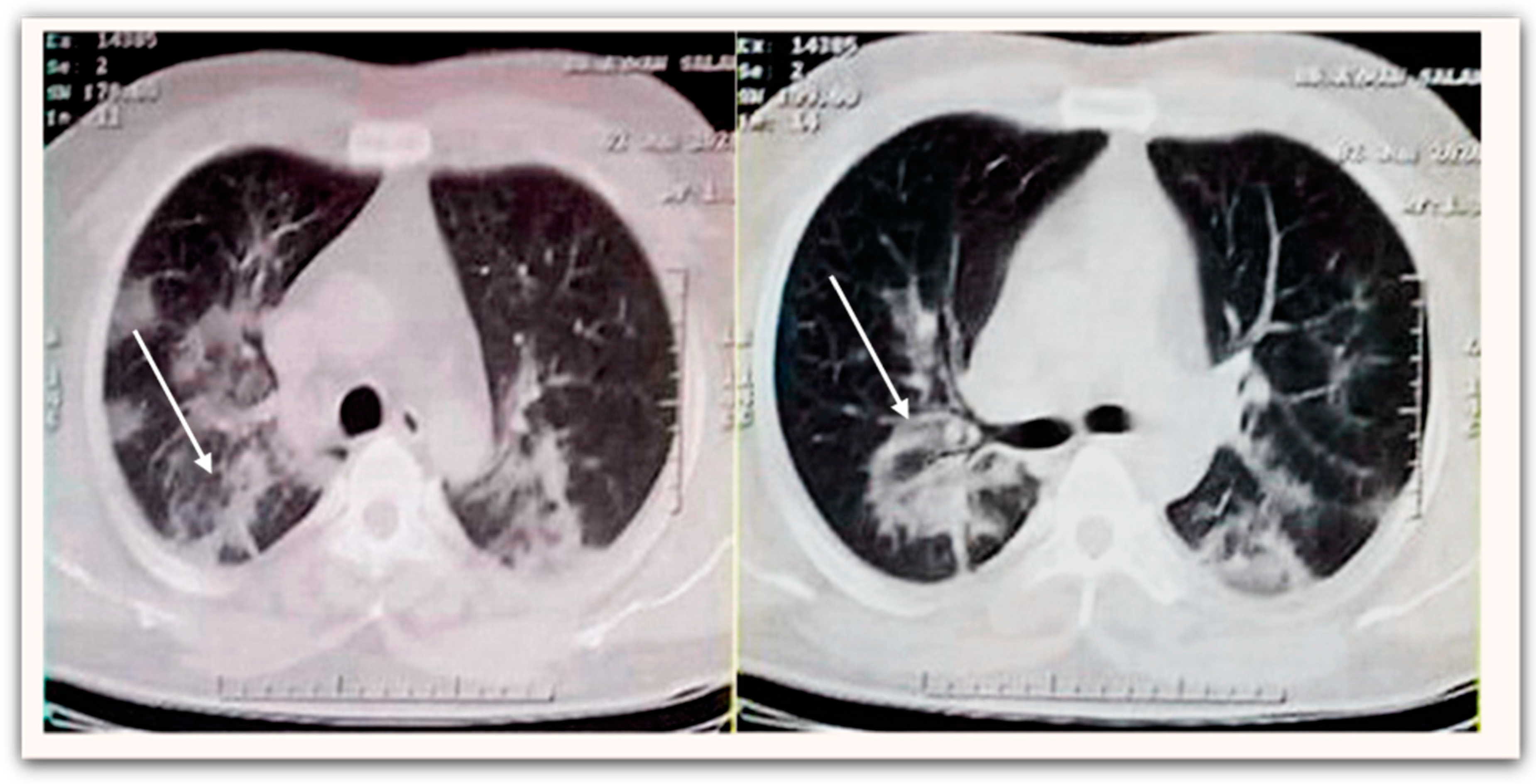 Medicina 58 00443 g001
