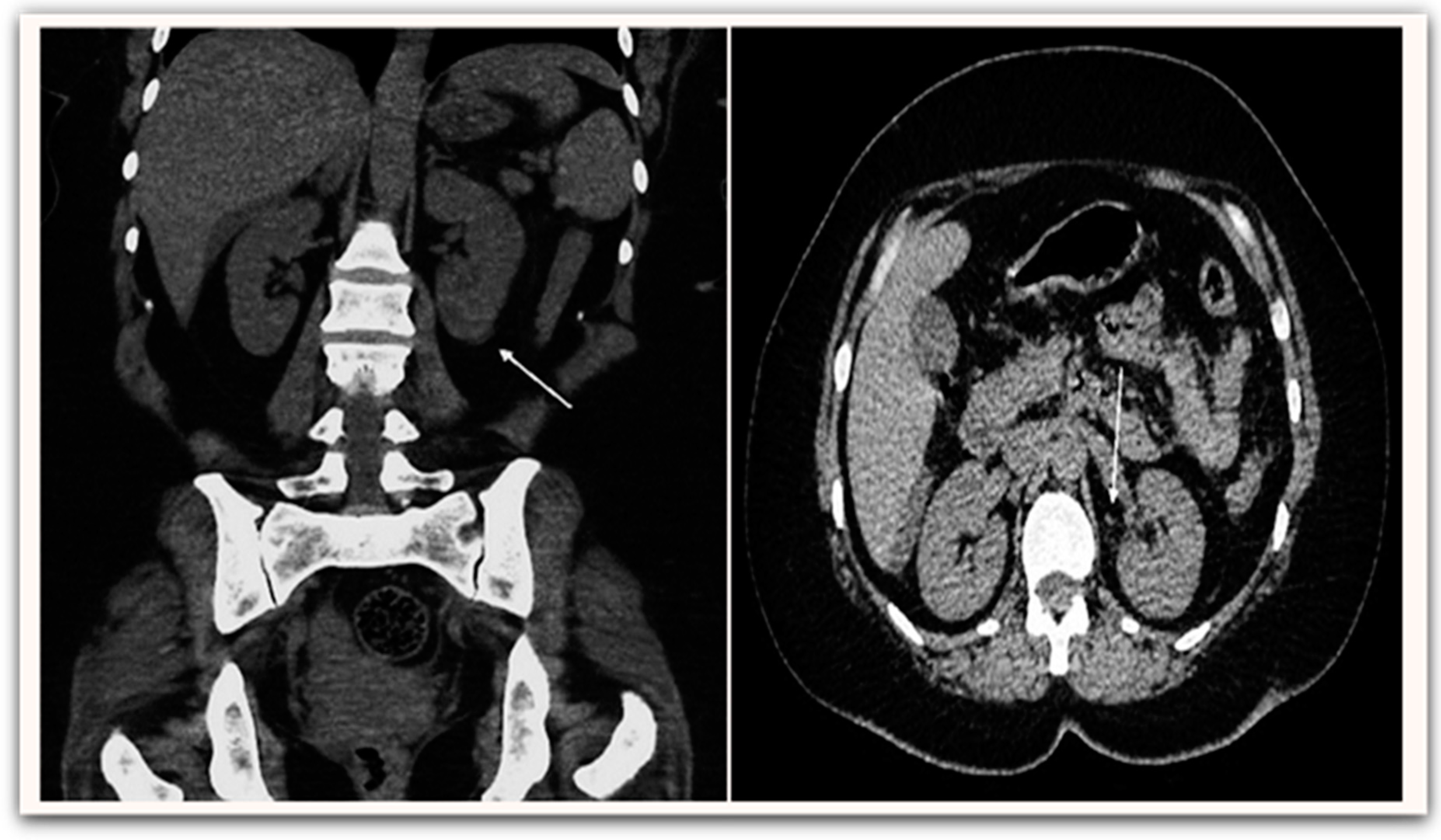 Medicina 58 00443 g003