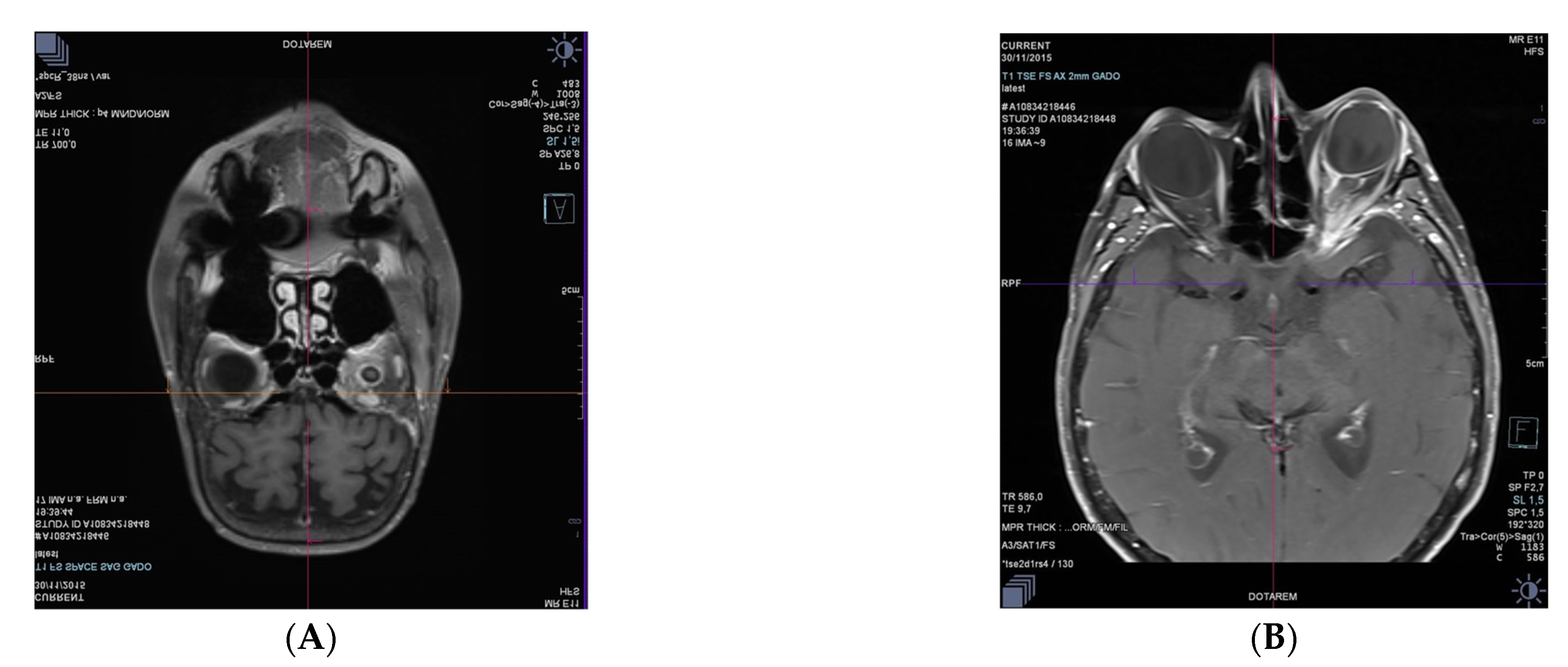 Medicina 58 00456 g003a 550