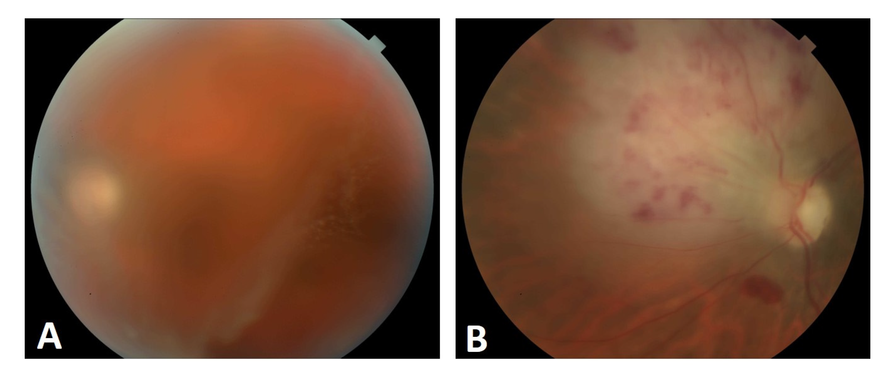 Medicina 58 00456 g004 550