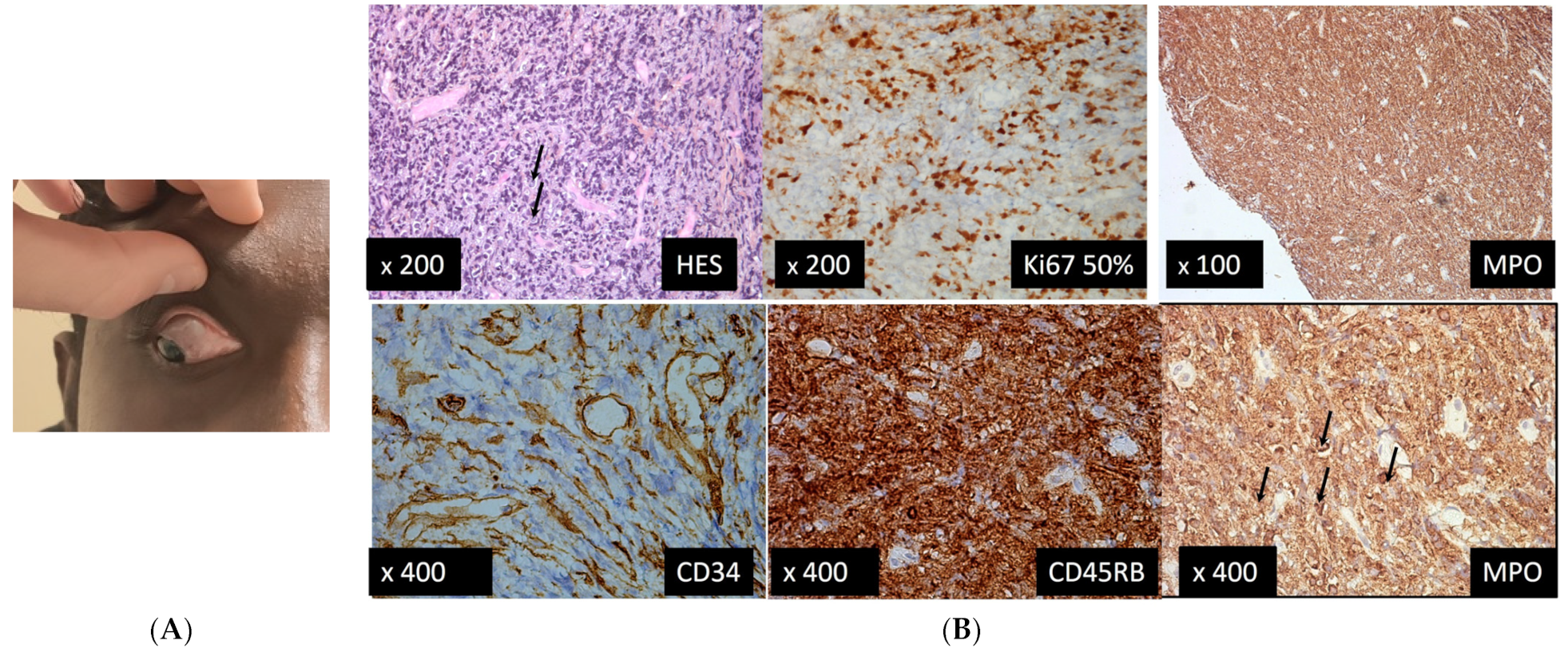 Medicina 58 00456 g006 550