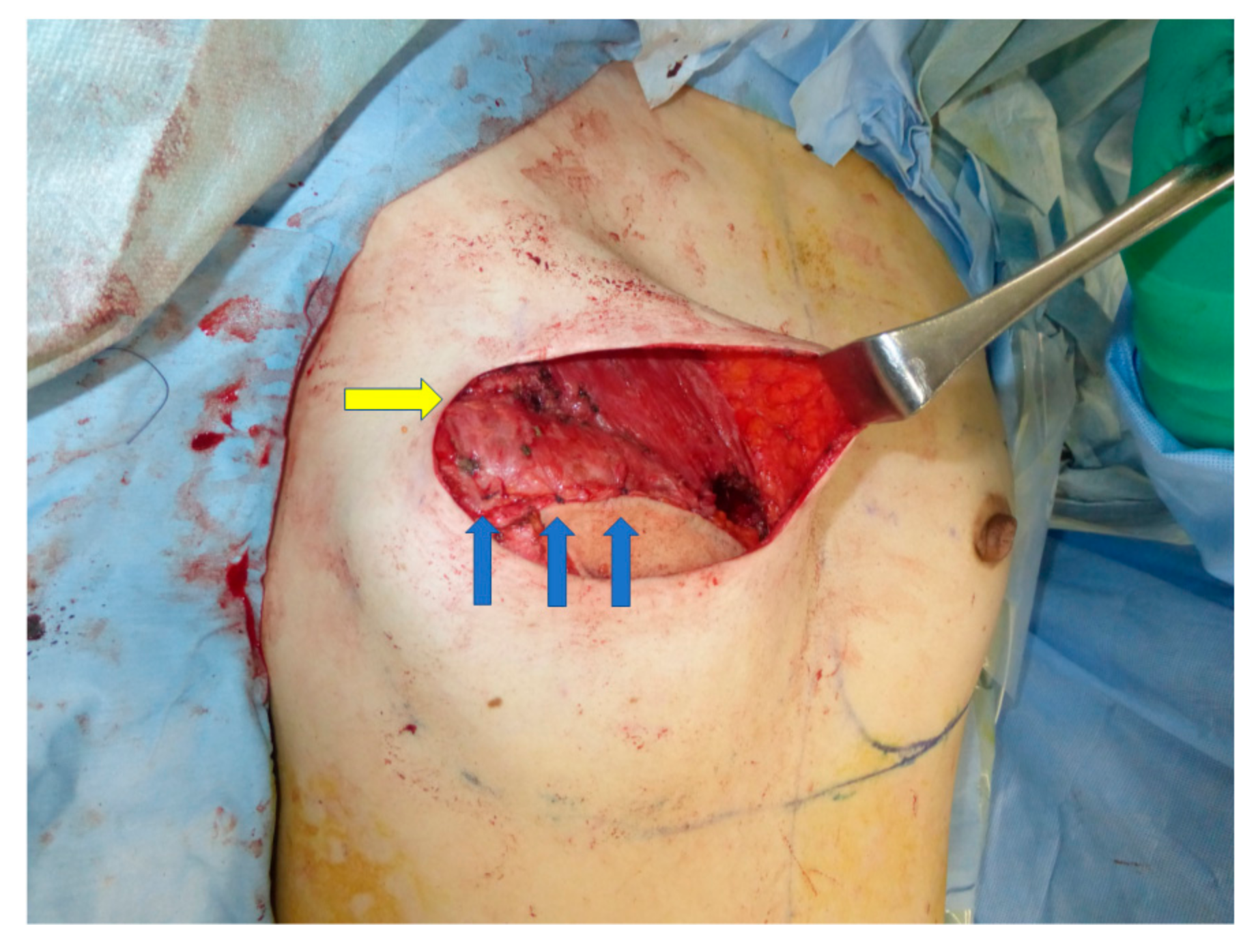 Medicina 58 00458 g002