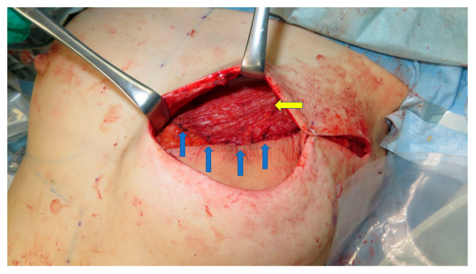 Medicina 58 00458 g005