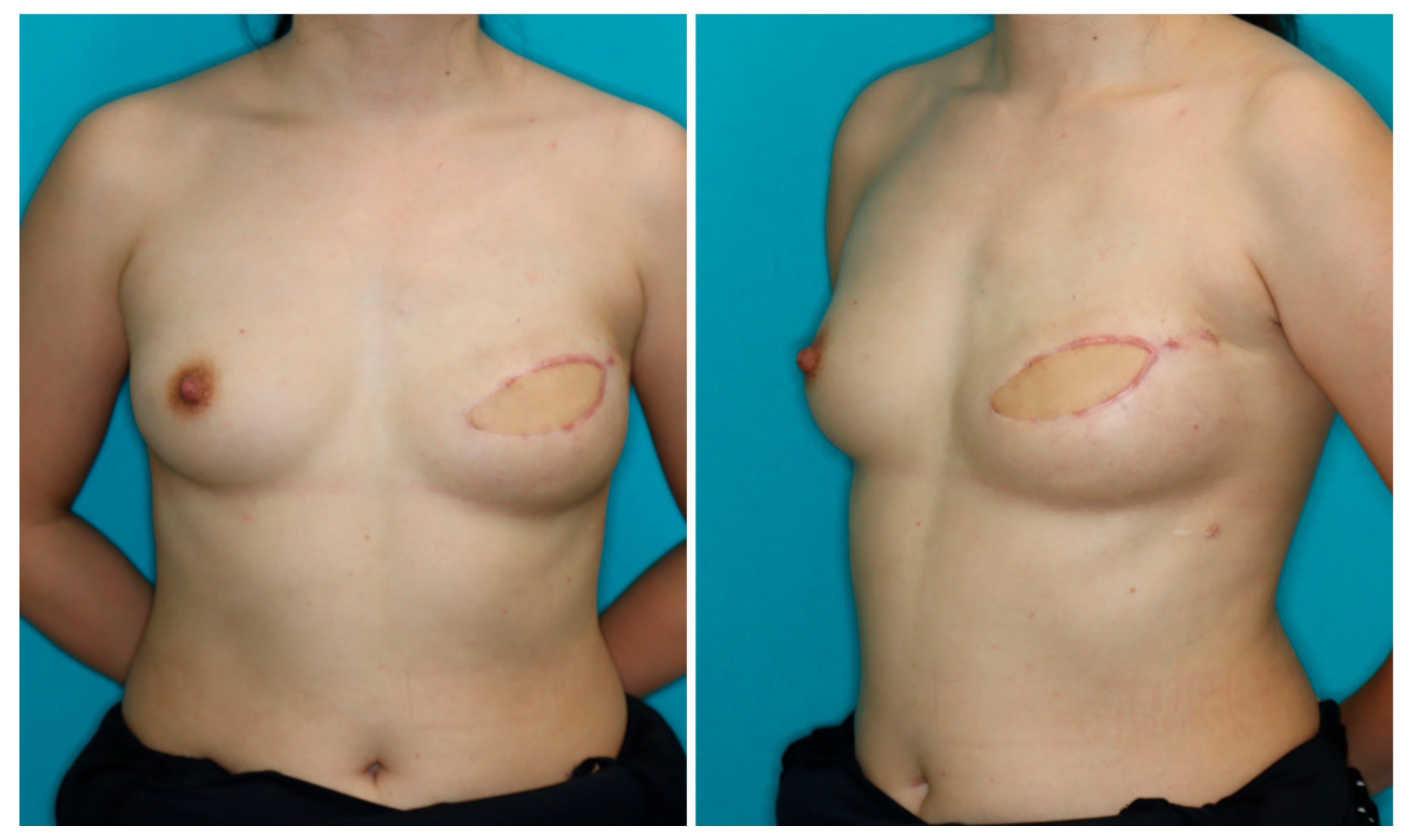 Medicina 58 00458 g006