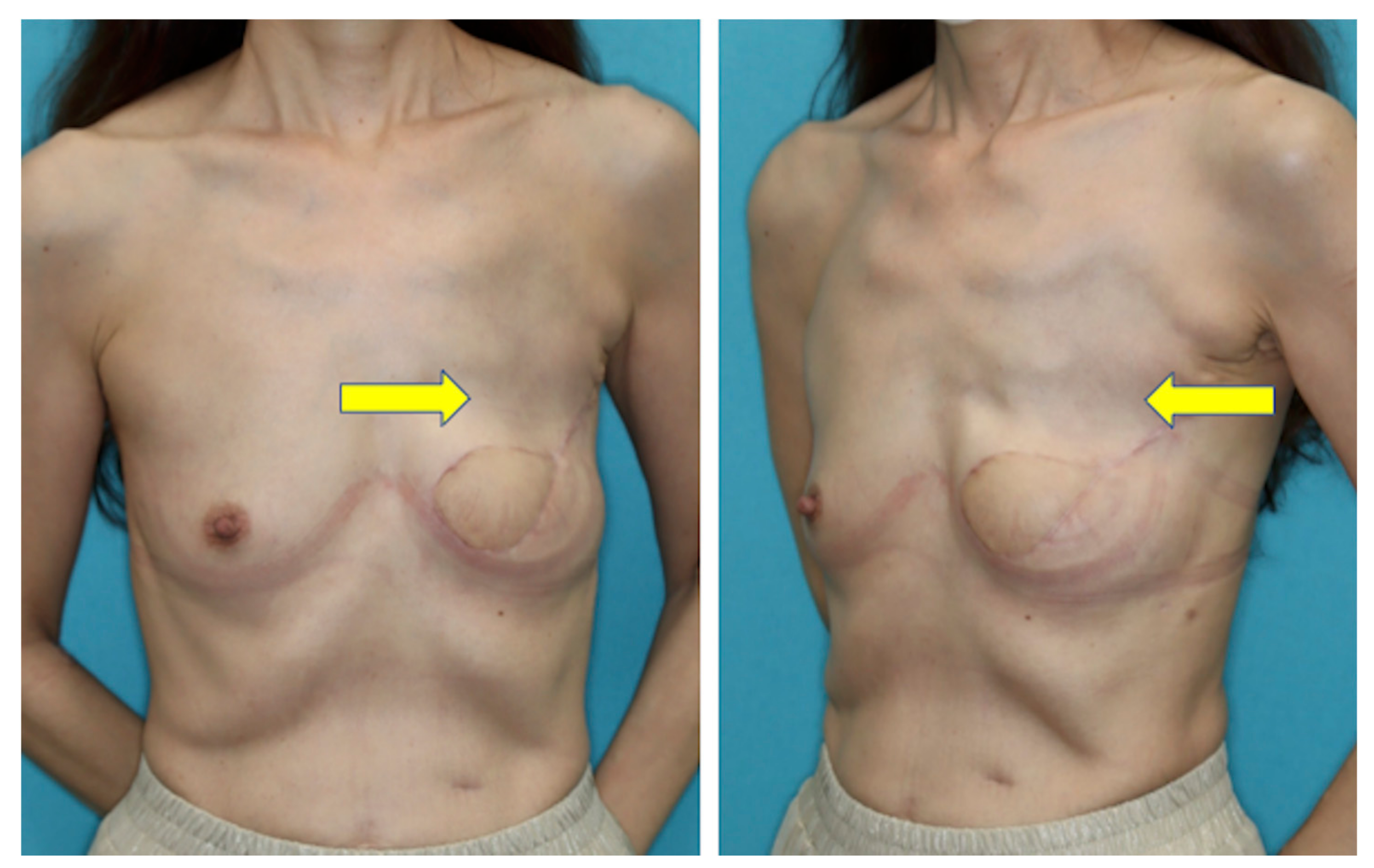 Medicina 58 00458 g007