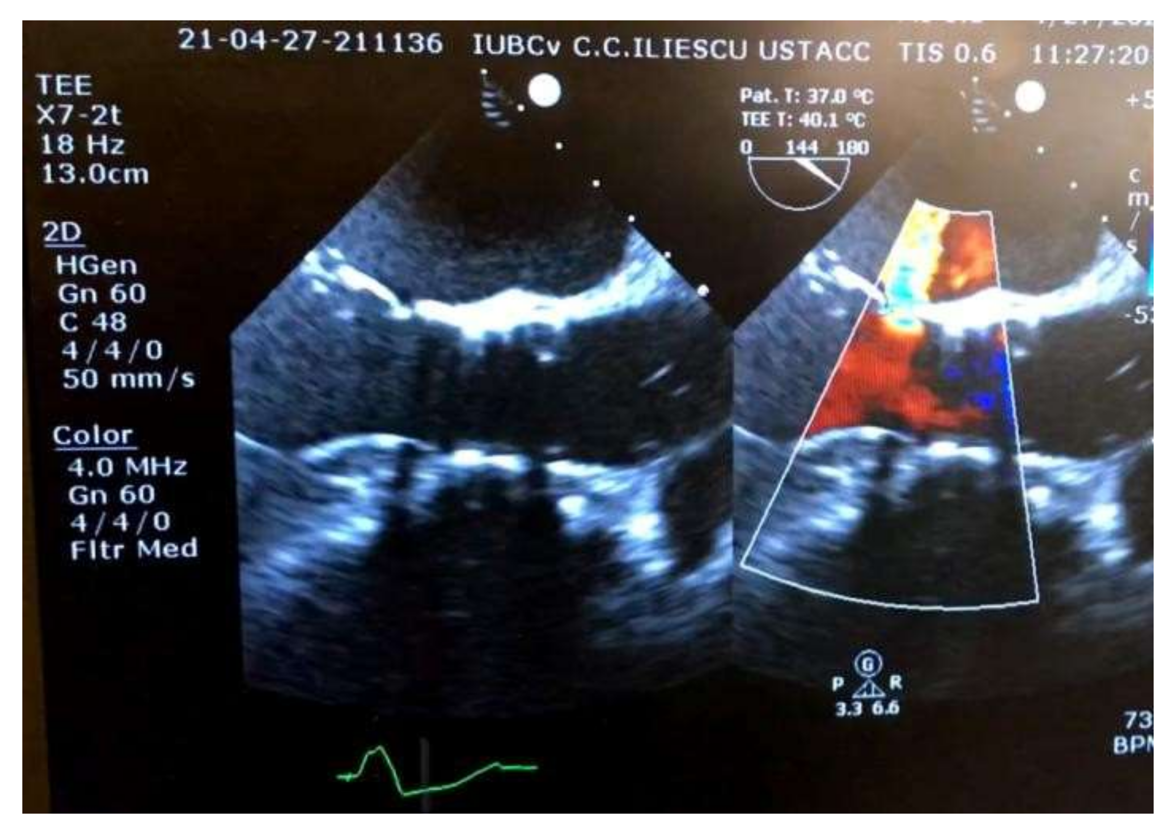 Medicina 58 00464 g004