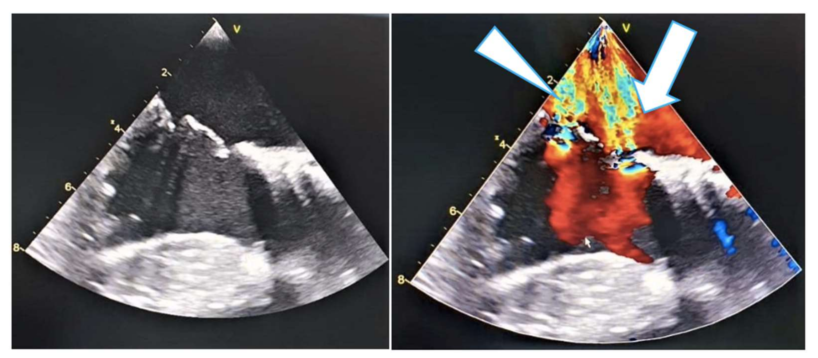 Medicina 58 00464 g007