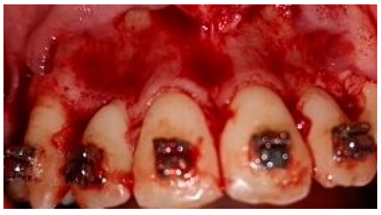 Medicina 58 00468 g001 550