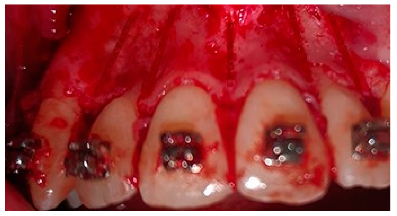 Medicina 58 00468 g002 550