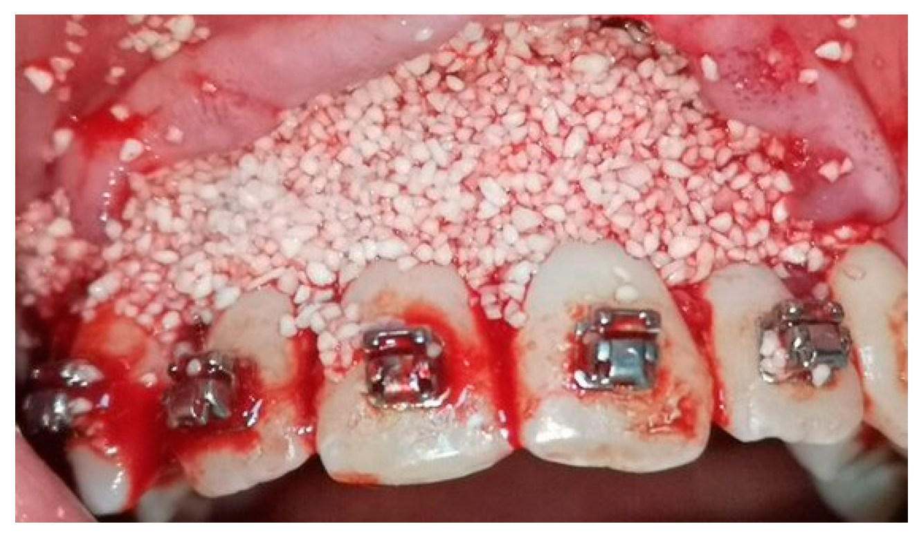 Medicina 58 00468 g003 550