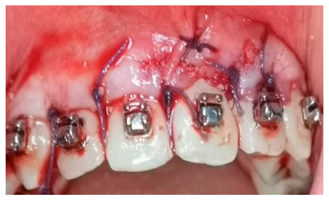 Medicina 58 00468 g004 550