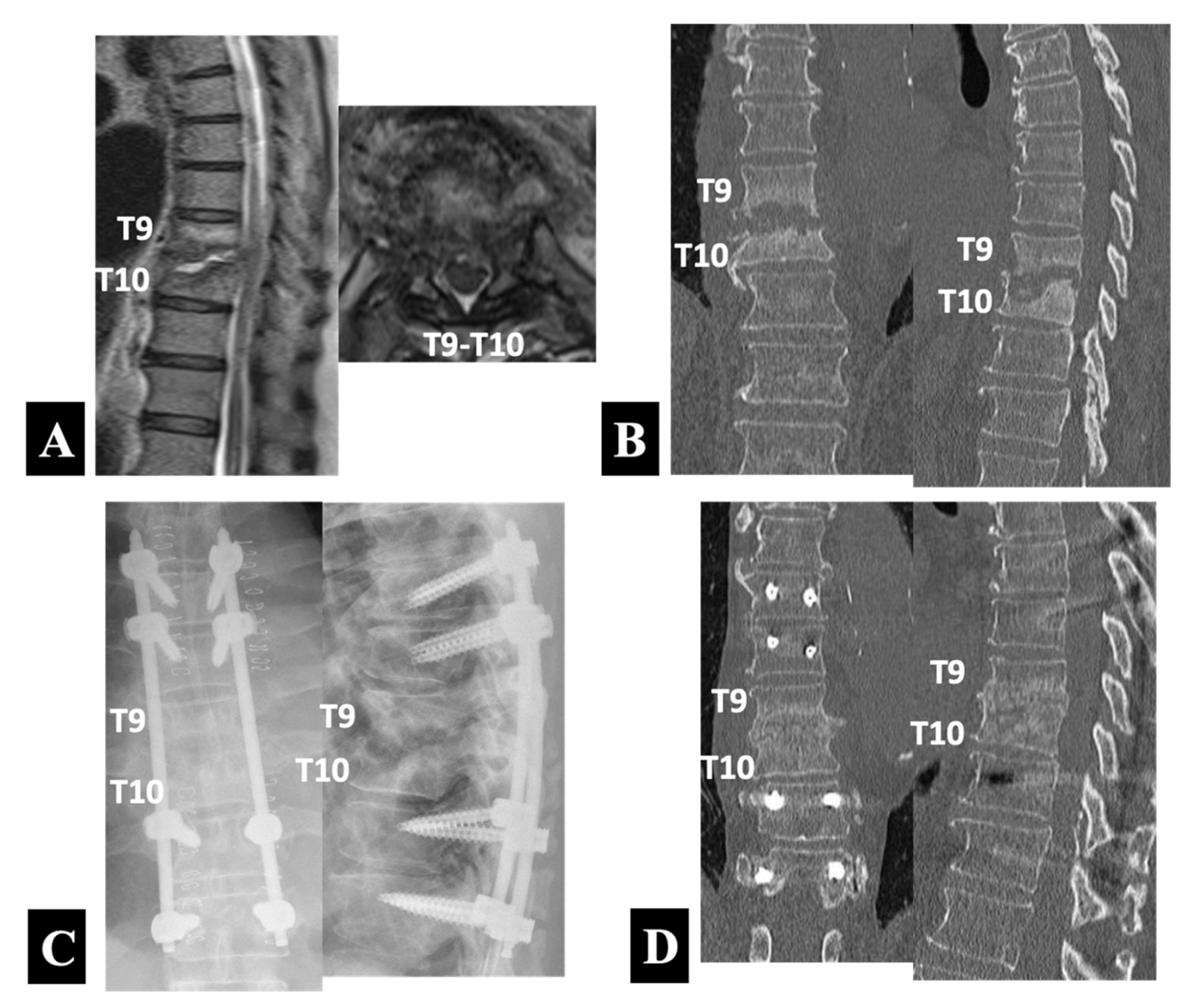 Medicina 58 00478 g003 550