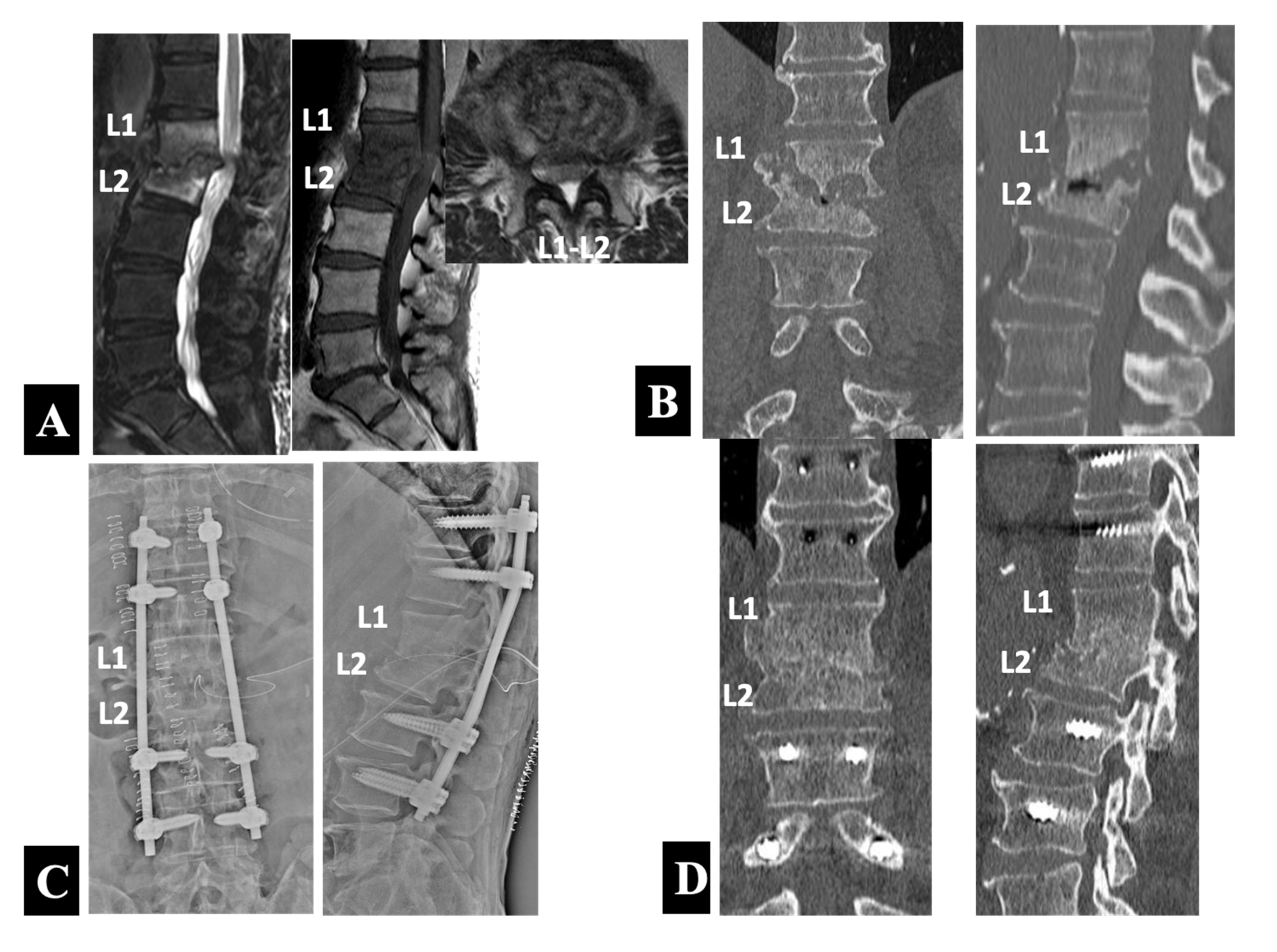 Medicina 58 00478 g004 550