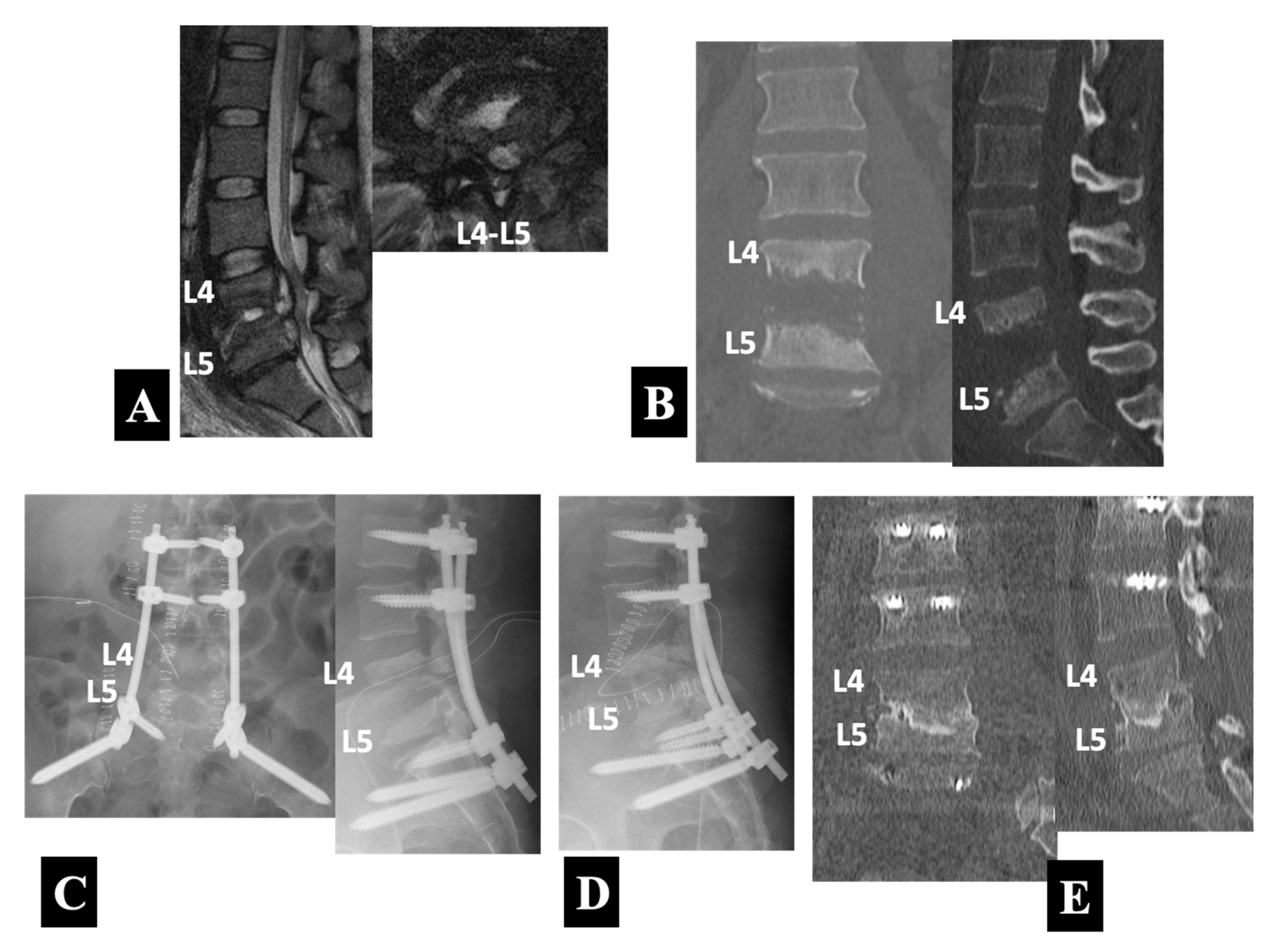 Medicina 58 00478 g005 550