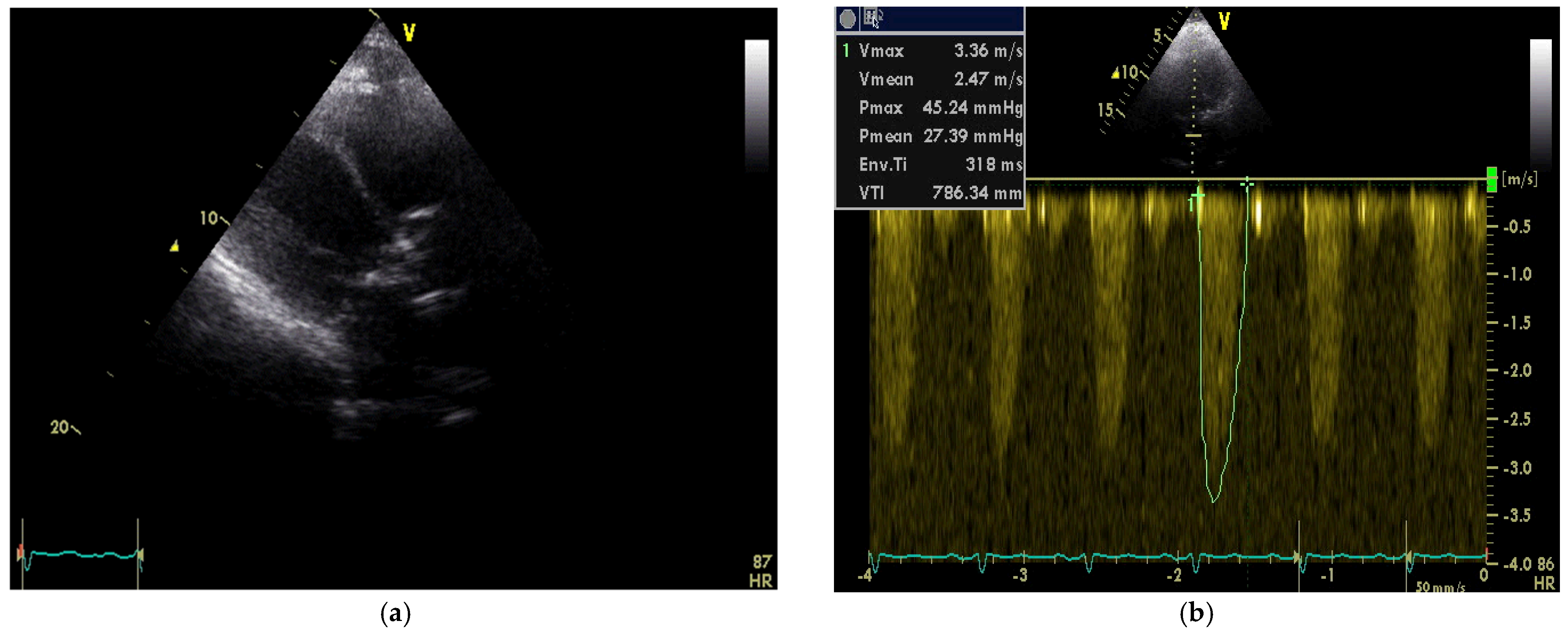 Medicina 58 00489 g002
