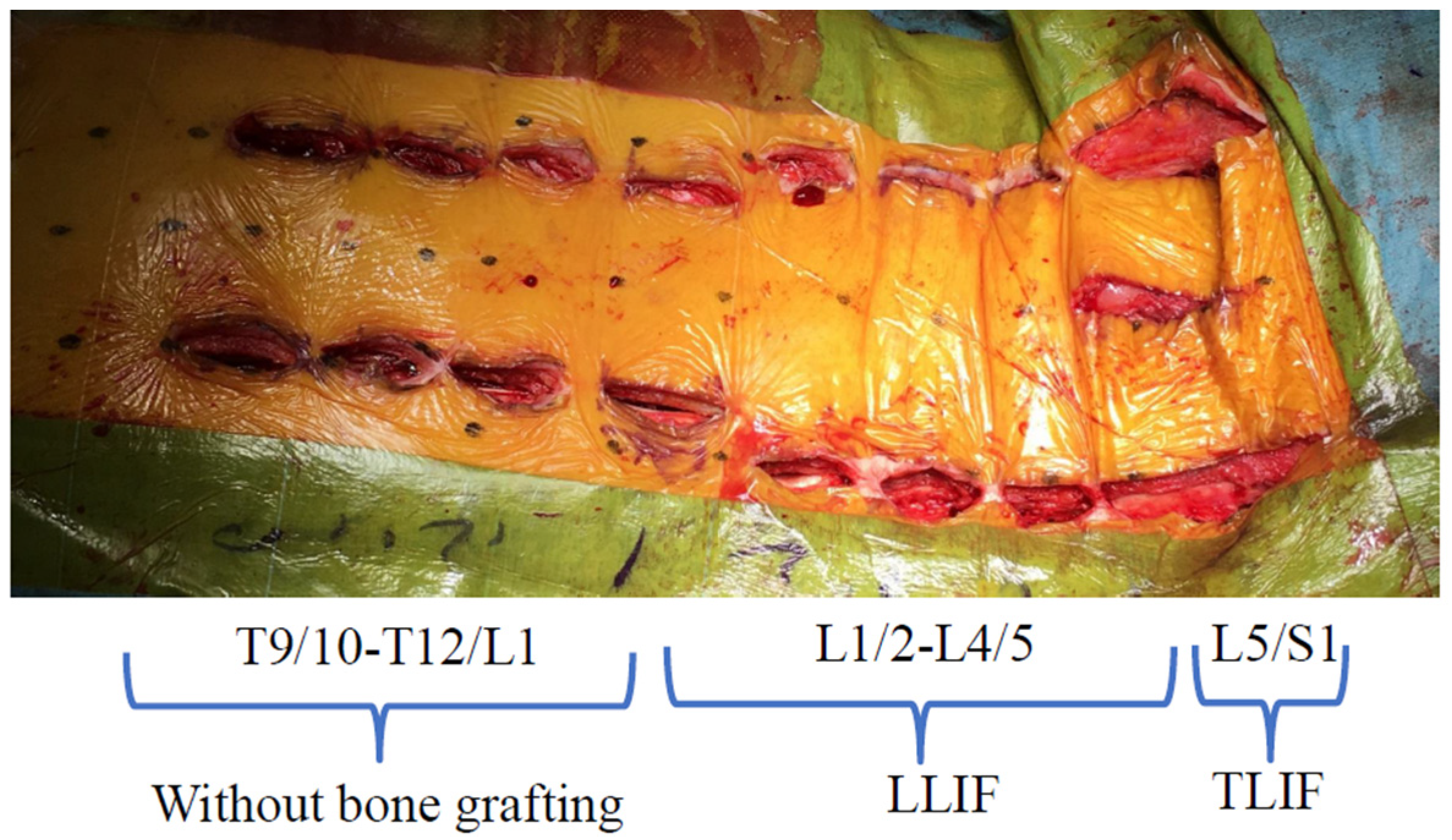 Medicina 58 00496 g003 550