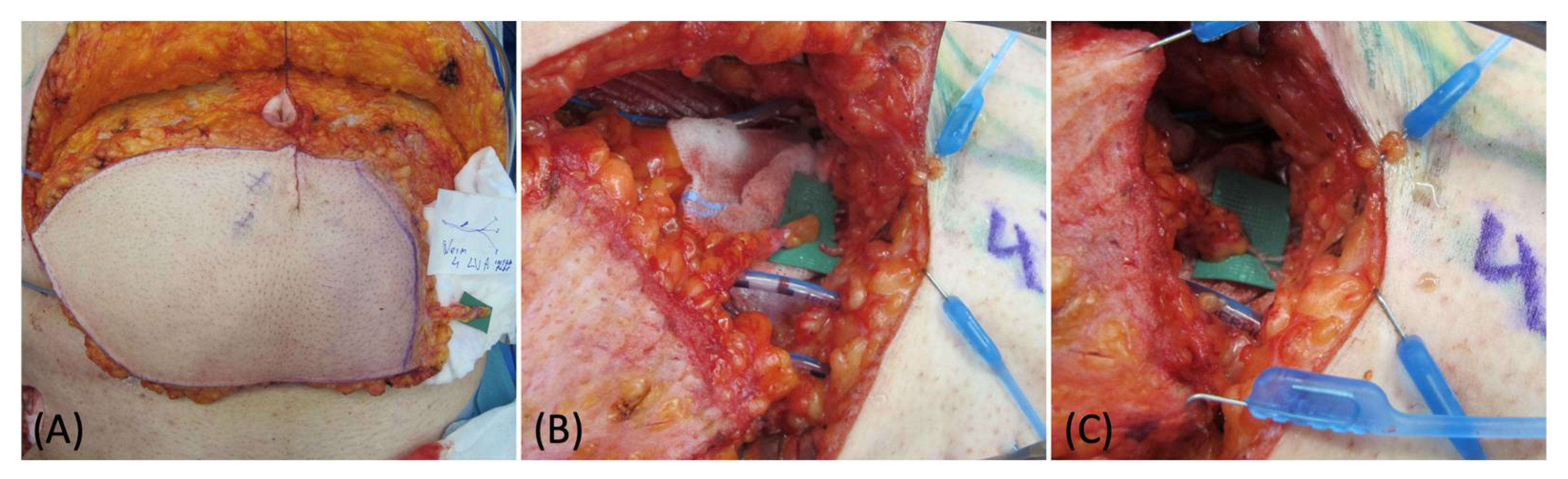 Medicina 58 00509 g001