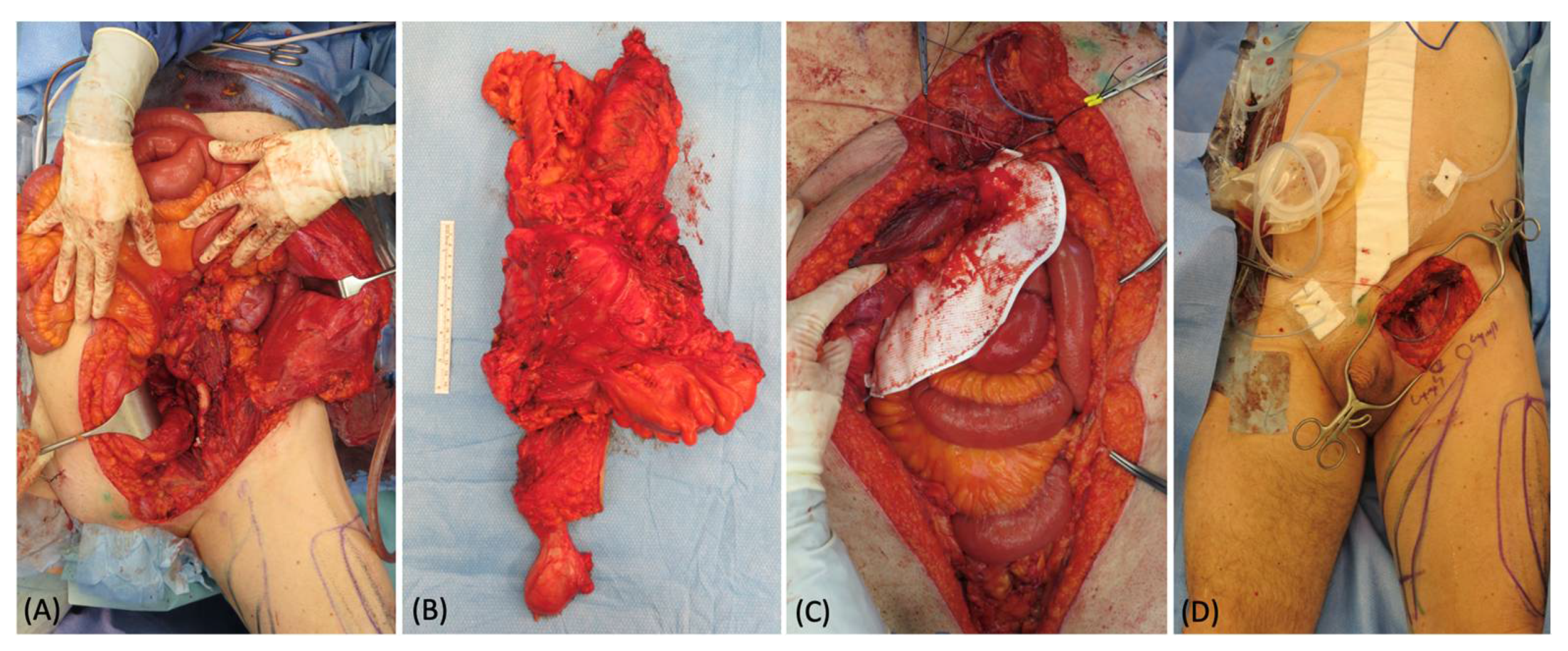 Medicina 58 00509 g003