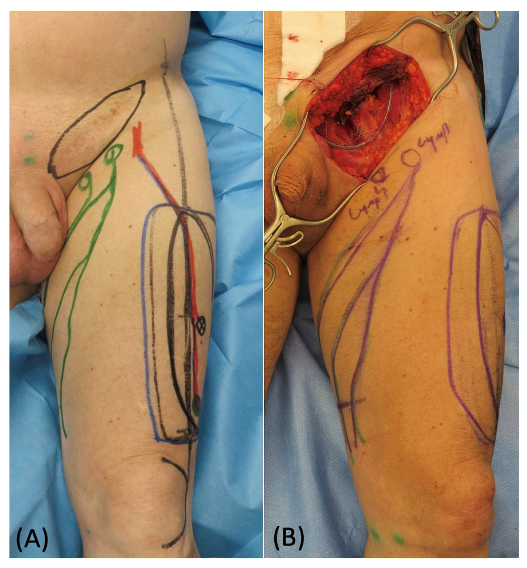 Medicina 58 00509 g004