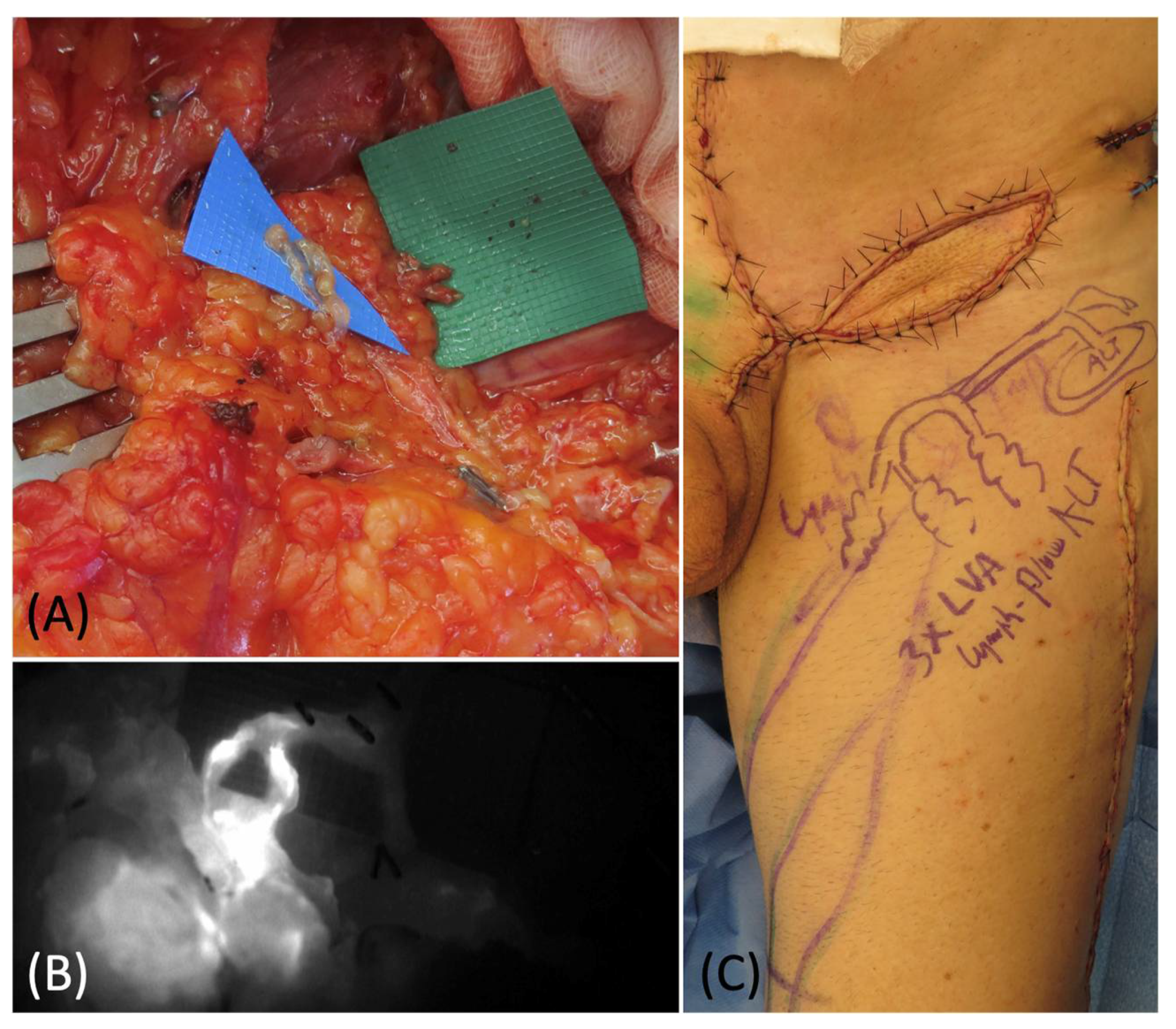 Medicina 58 00509 g005