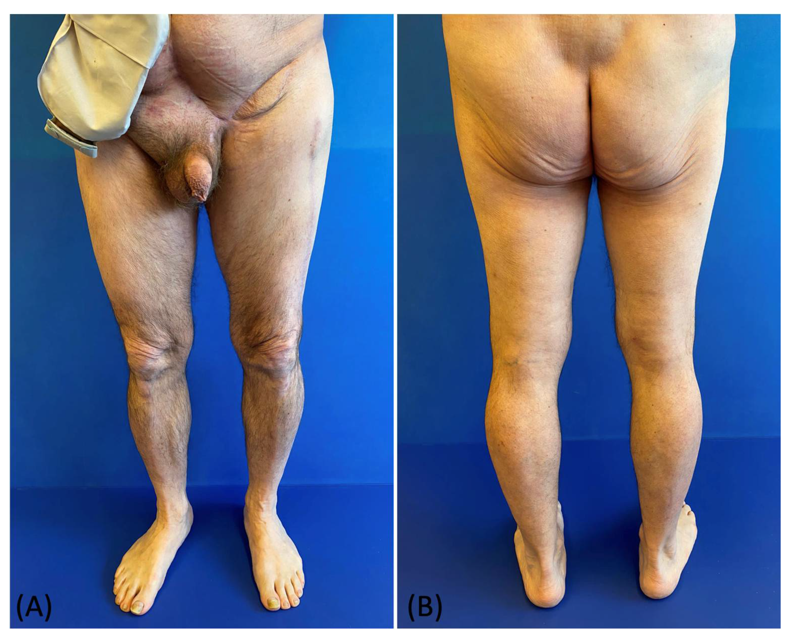 Medicina 58 00509 g006