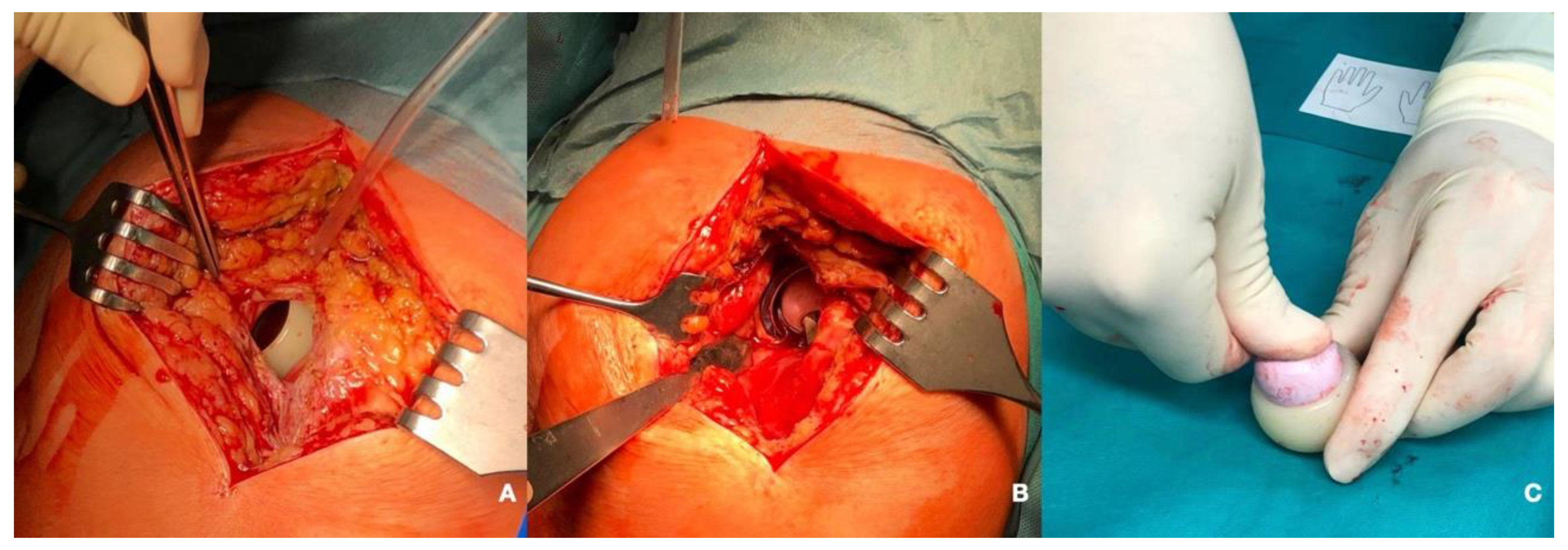 Medicina 58 00528 g003 Medicina 58 00528 g003