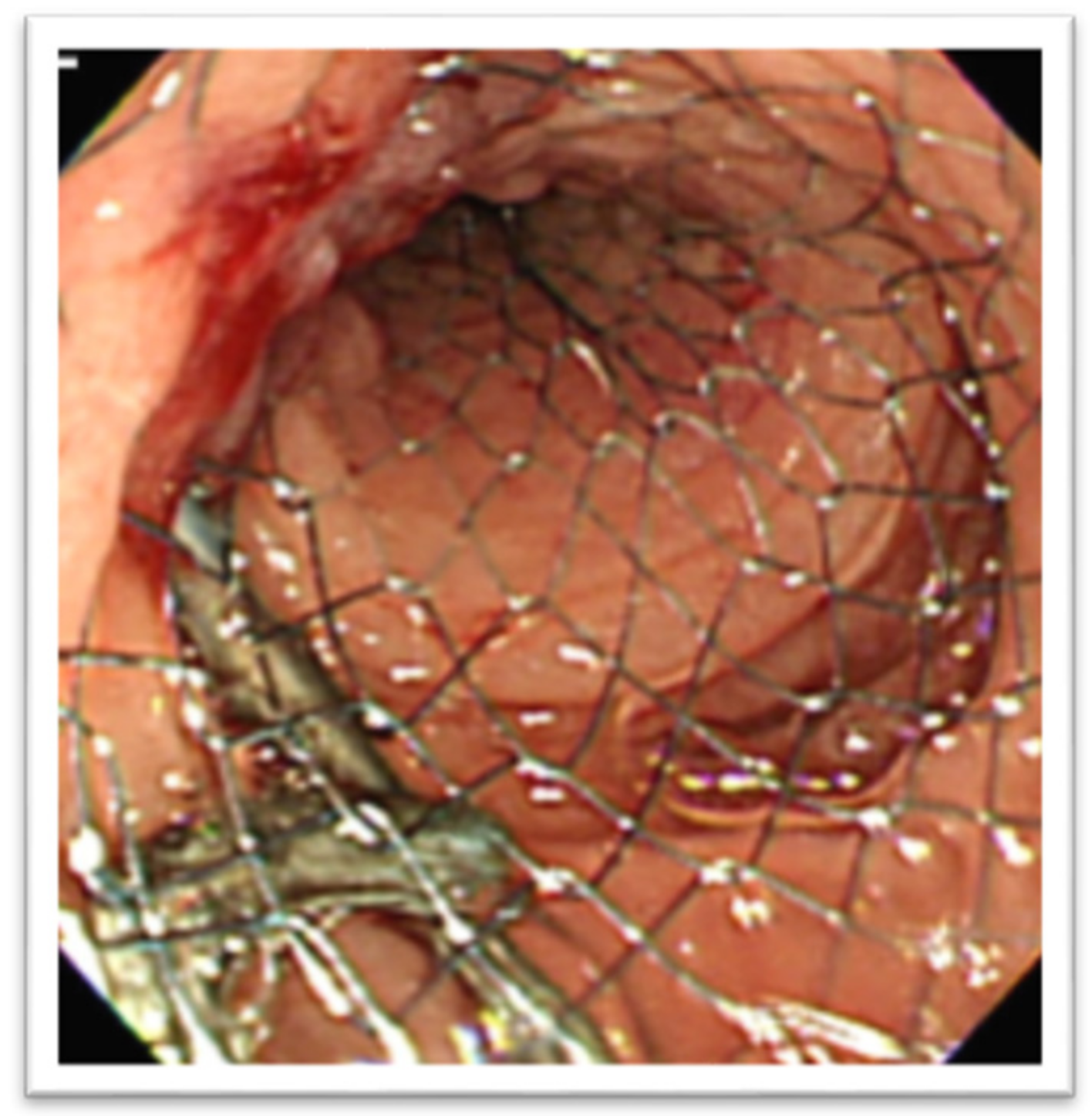 Medicina 58 00532 g011 550