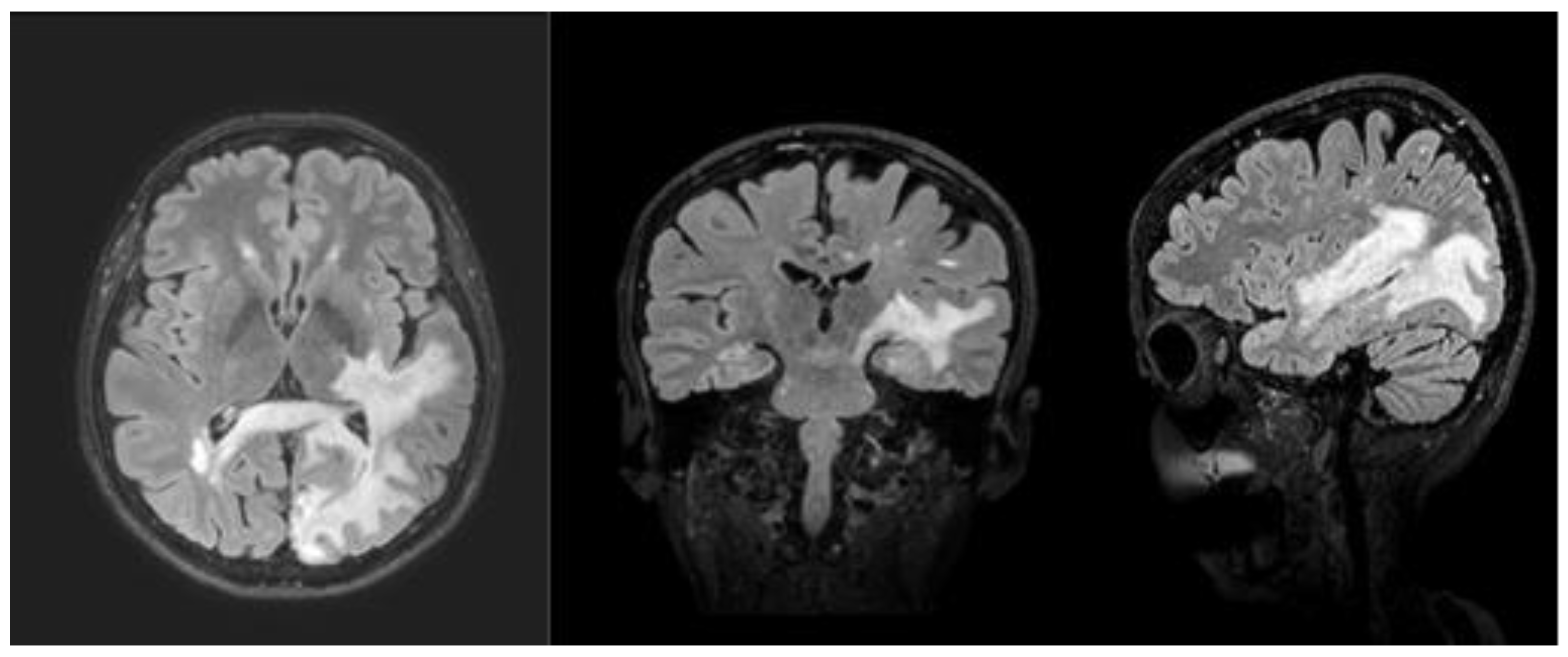 Medicina 58 00551 g001
