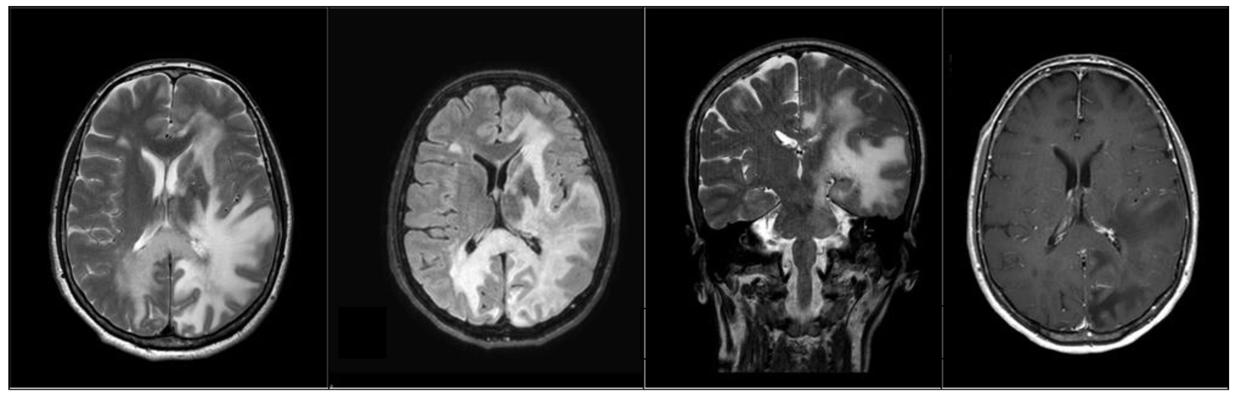 Medicina 58 00551 g002