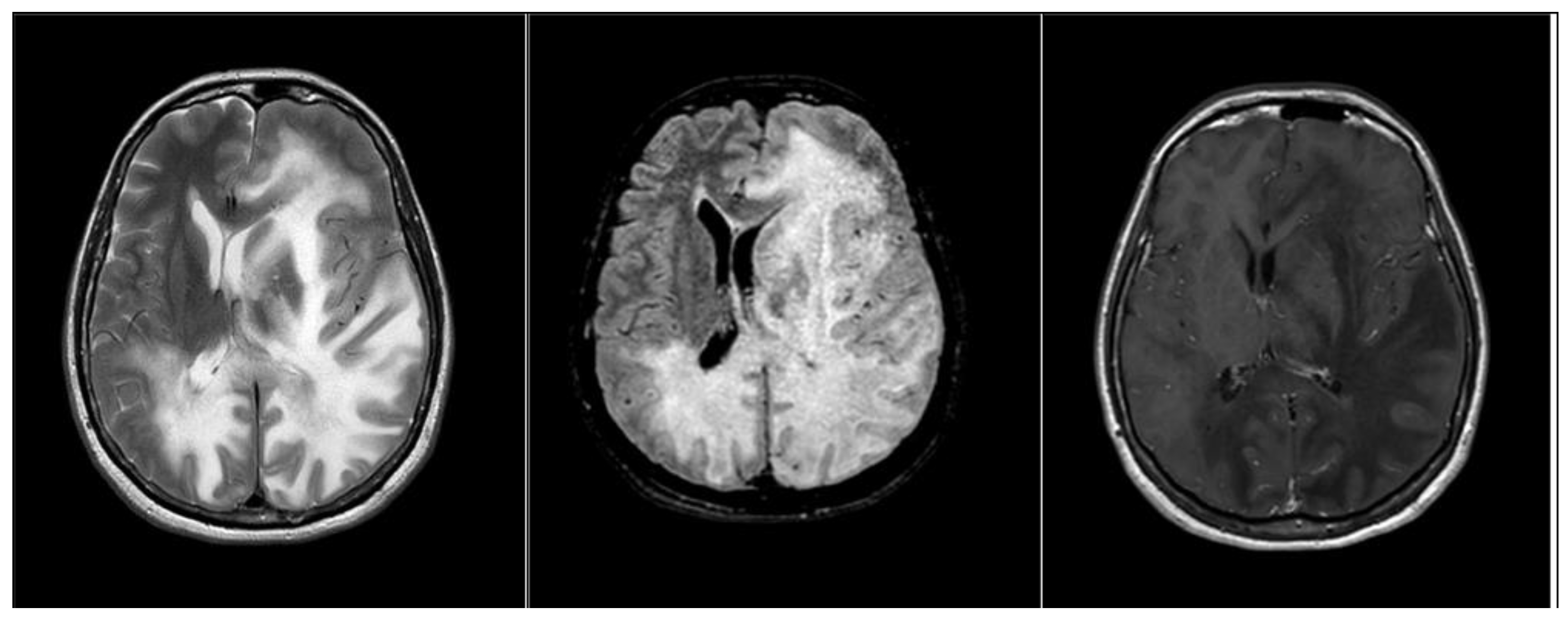 Medicina 58 00551 g003