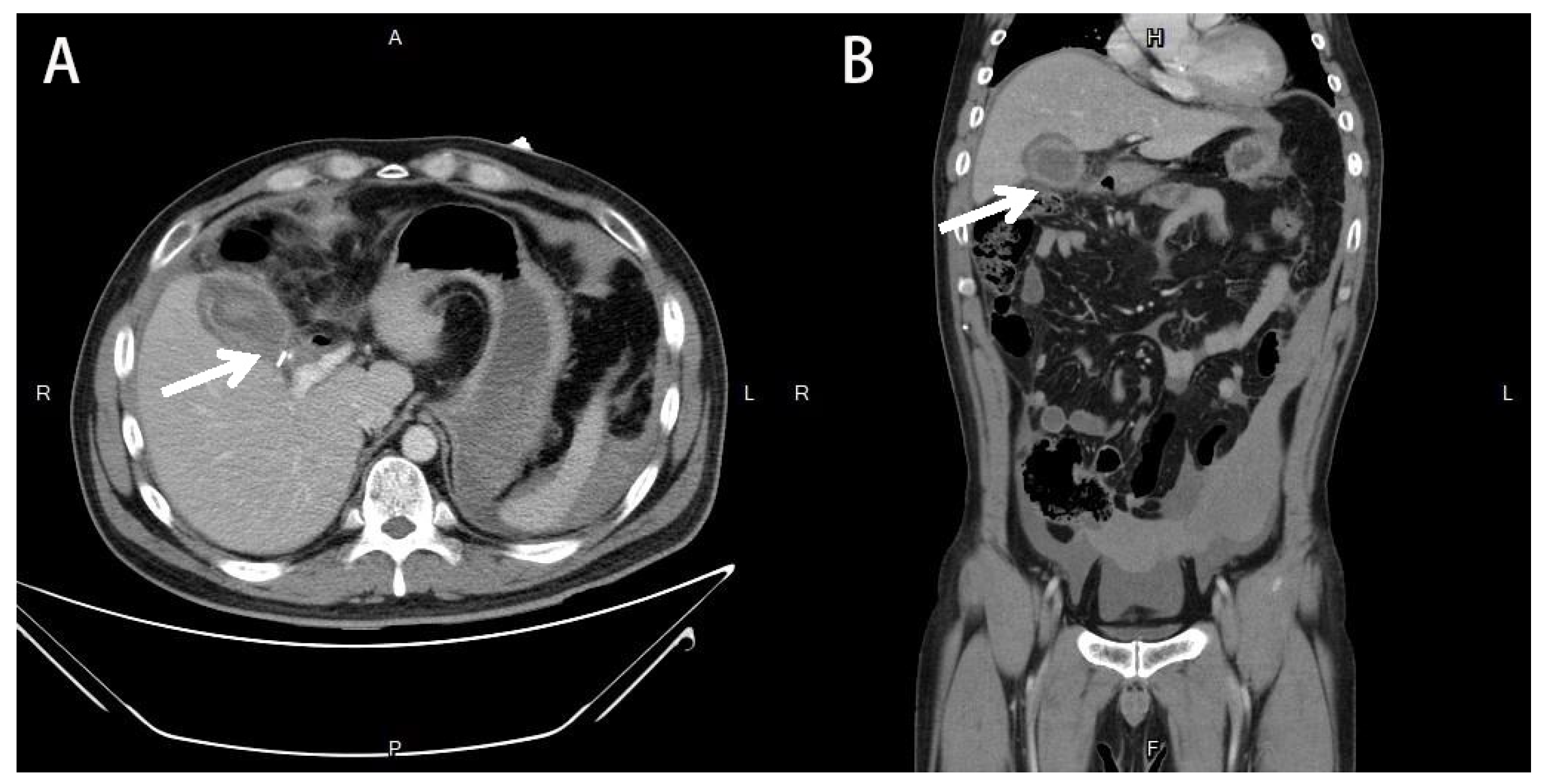 Medicina 58 00568 g001