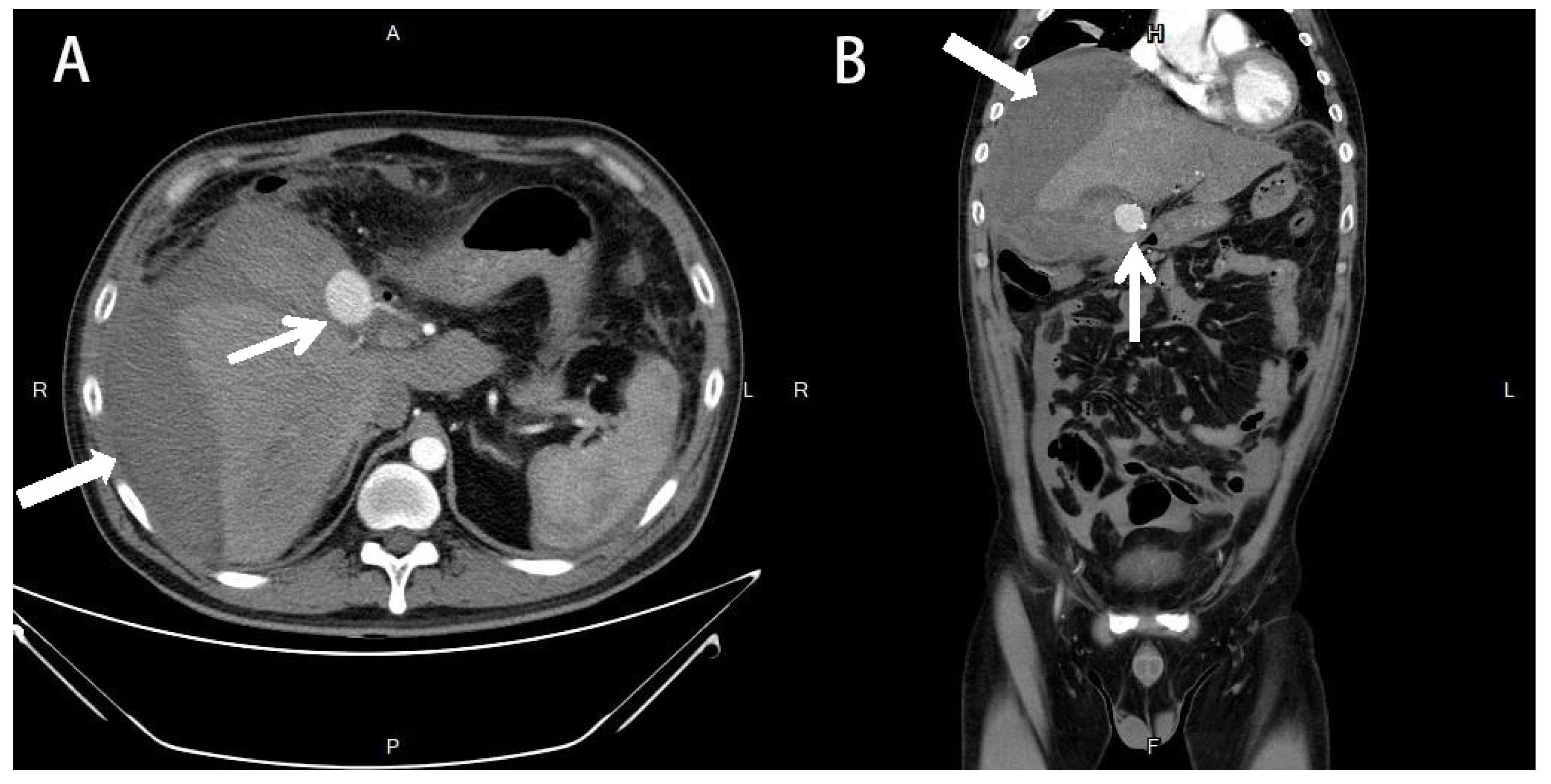 Medicina 58 00568 g002