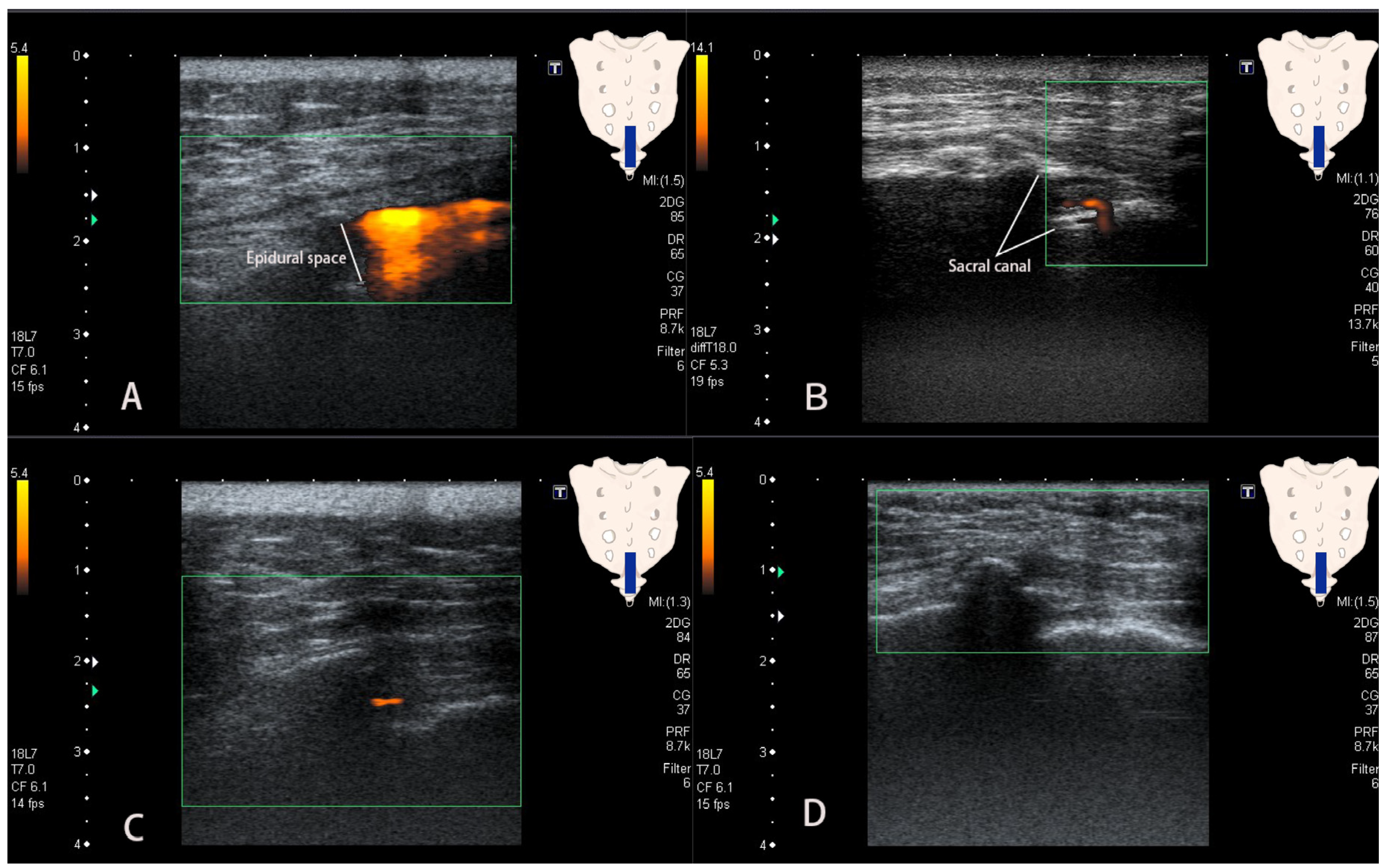 Medicina 58 00575 g002 Medicina 58 00575 g002