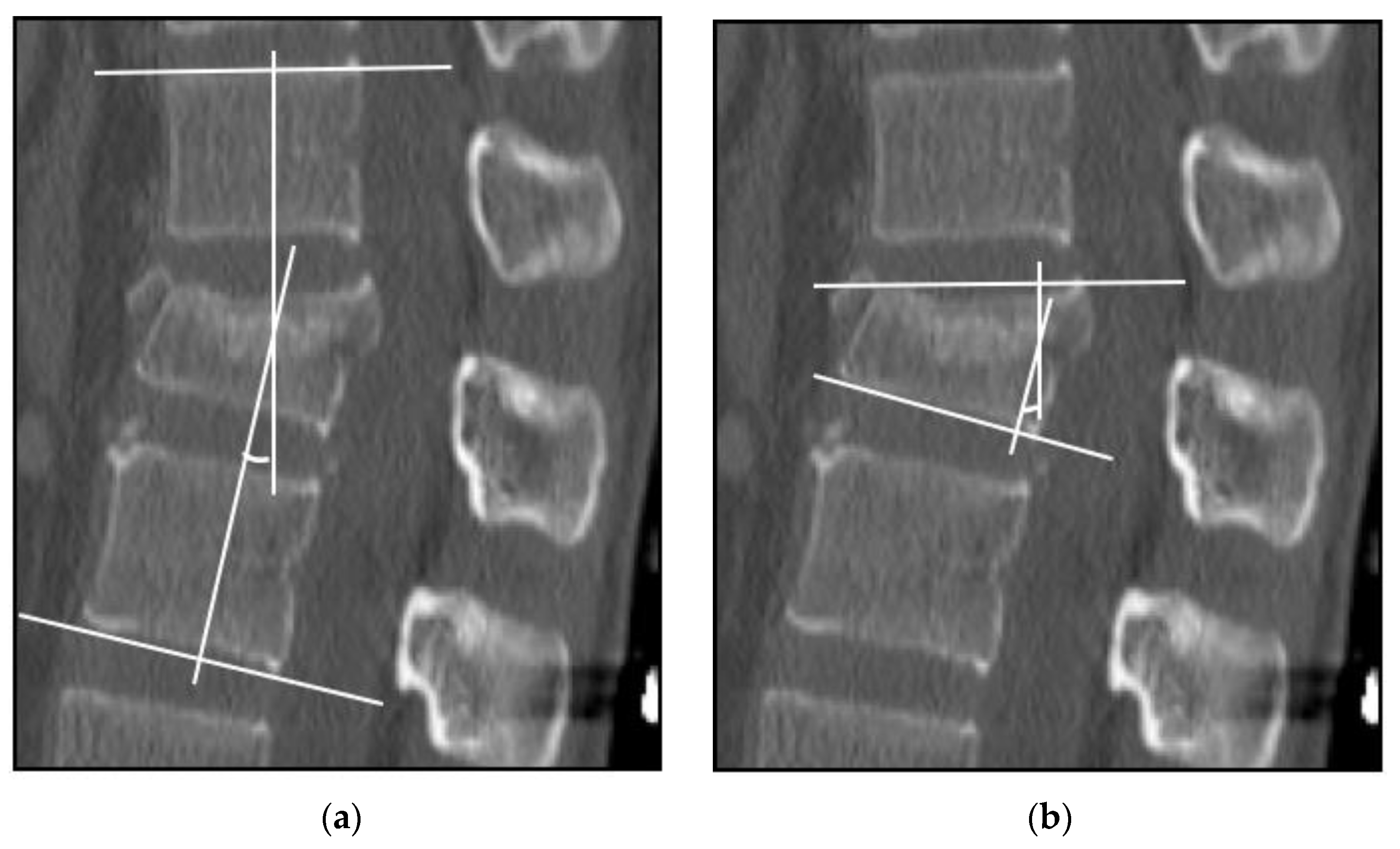 Medicina 58 00583 g001 Medicina 58 00583 g001