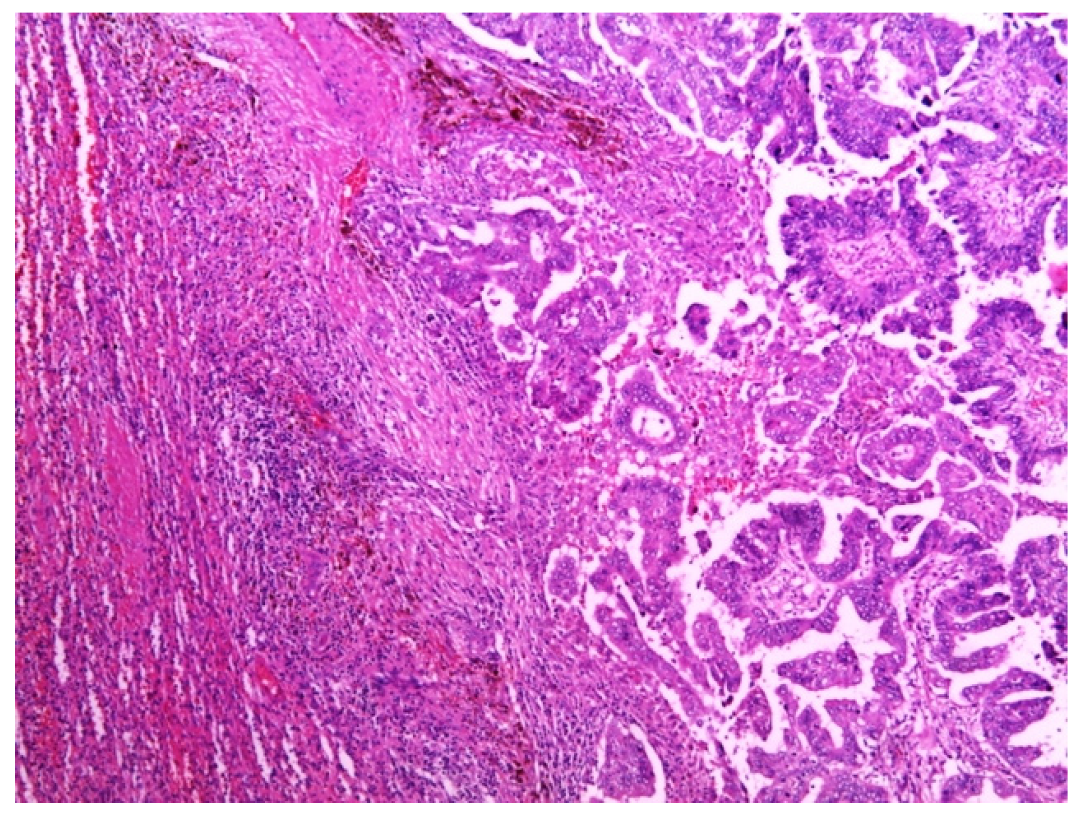 Medicina 58 00592 g002