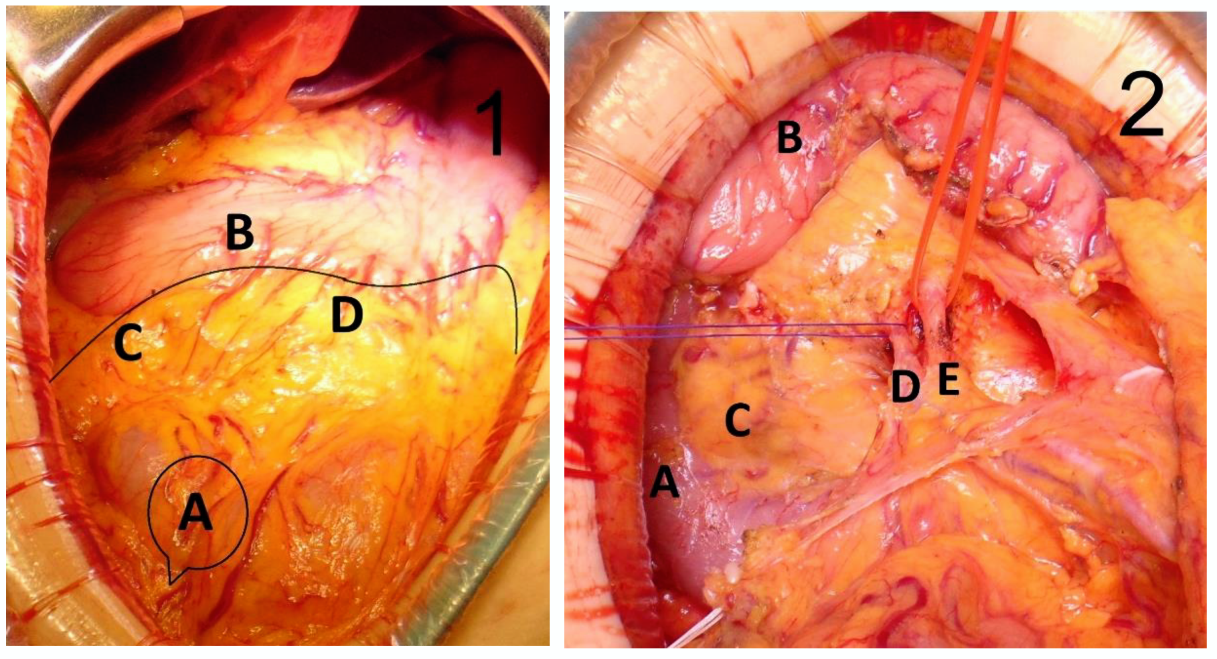 Medicina 58 00596 g002a 550