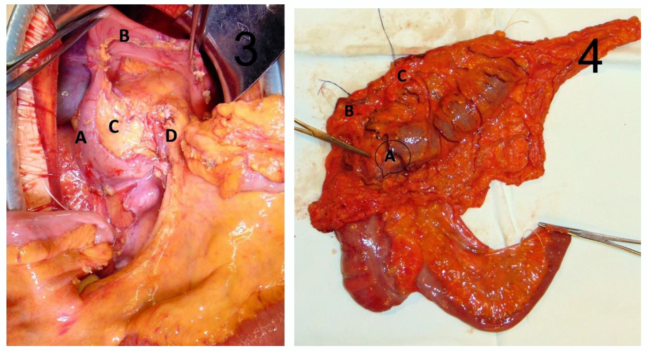 Medicina 58 00596 g002b 550