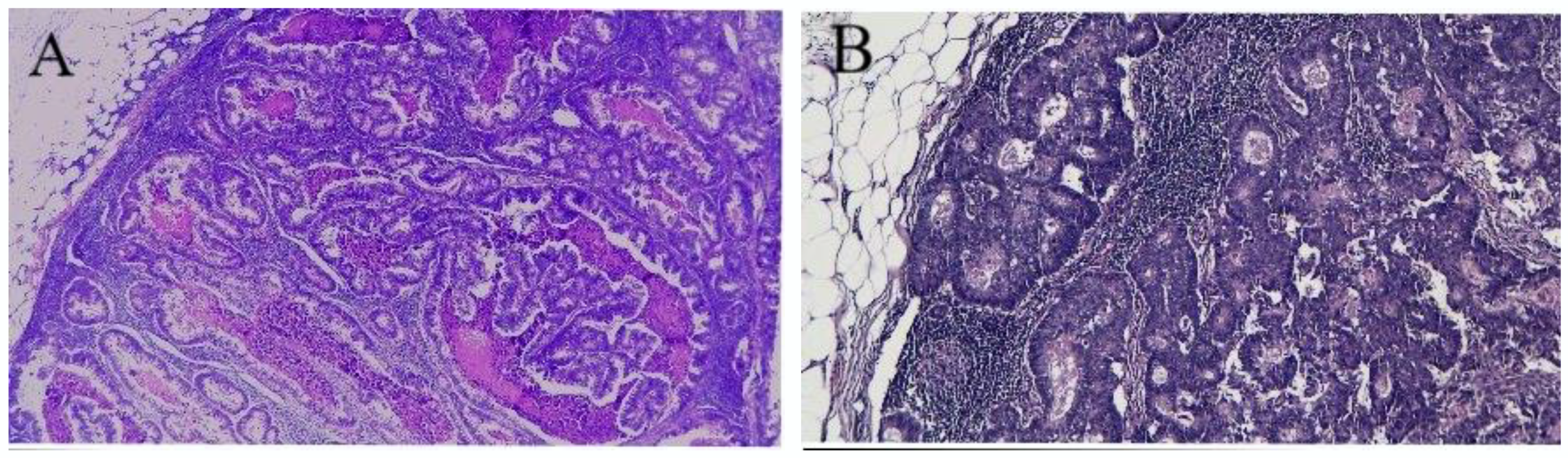 Medicina 58 00596 g003 550